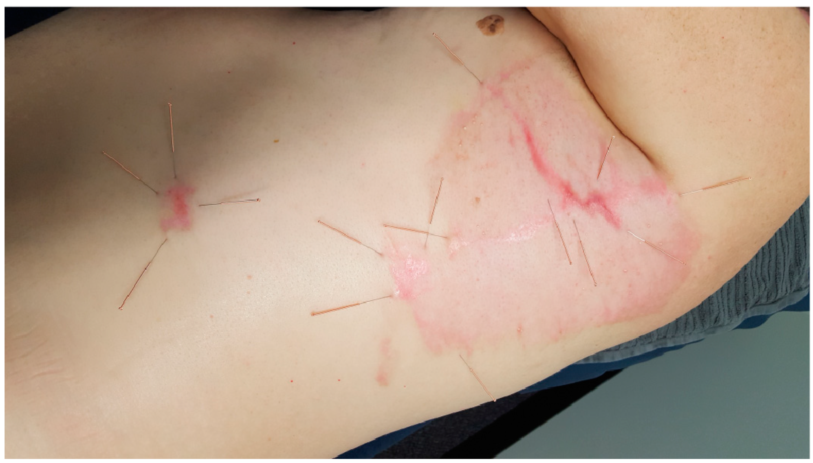 Jcm 13 03994 g001 Jcm 13 03994 g001