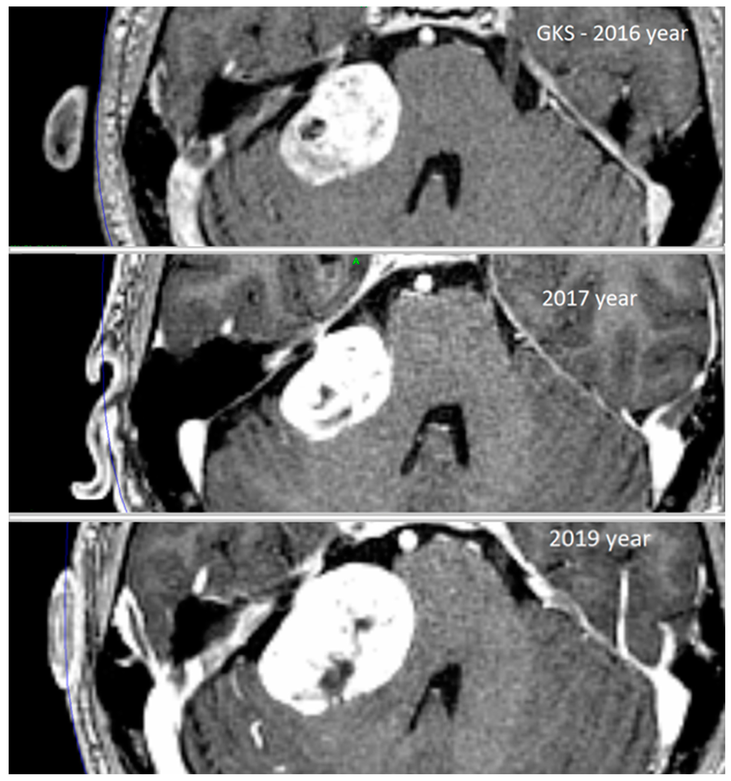 Jcm 13 04107 g002 Jcm 13 04107 g002