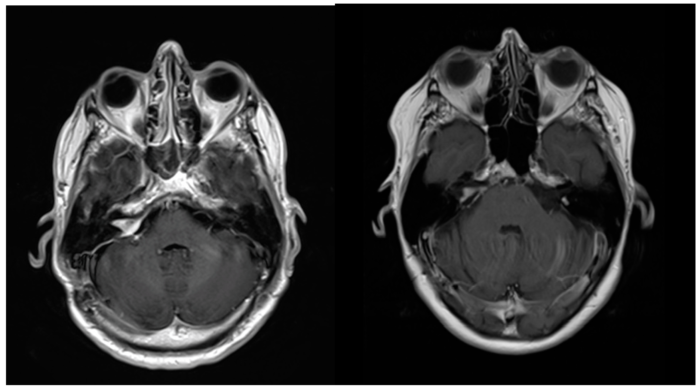 Jcm 13 04107 g003 Jcm 13 04107 g003