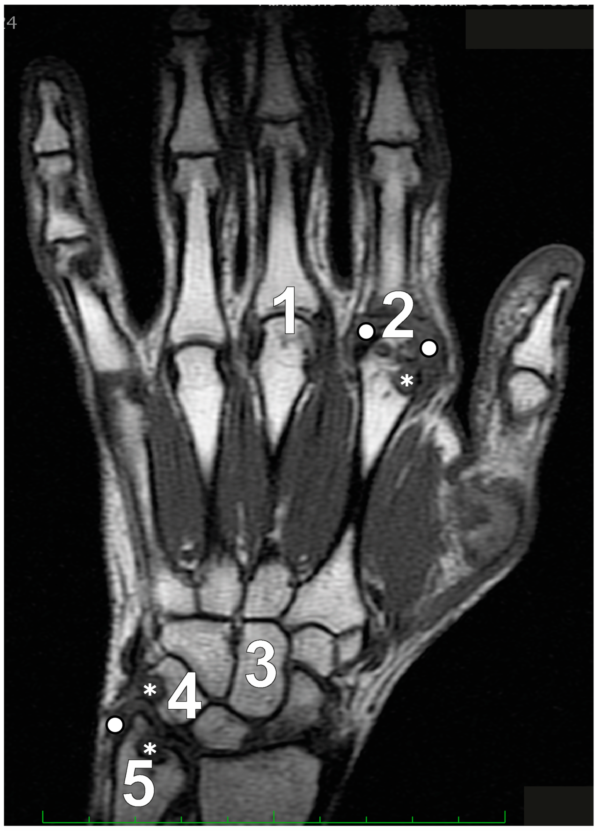 Jcm 13 04137 g002 Jcm 13 04137 g002