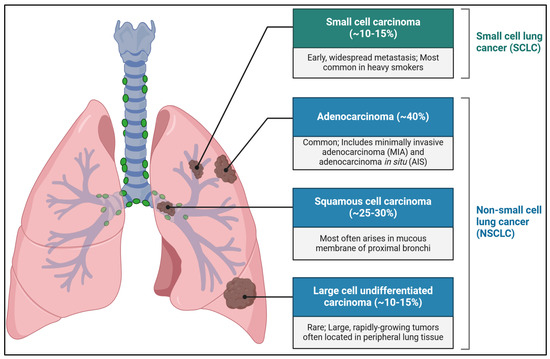 健康・医学 Diagnostic Atlas of Non-Neoplastic Lung Diagnostic Atlas of Non-Neoplastic Lung Disease: A Practical