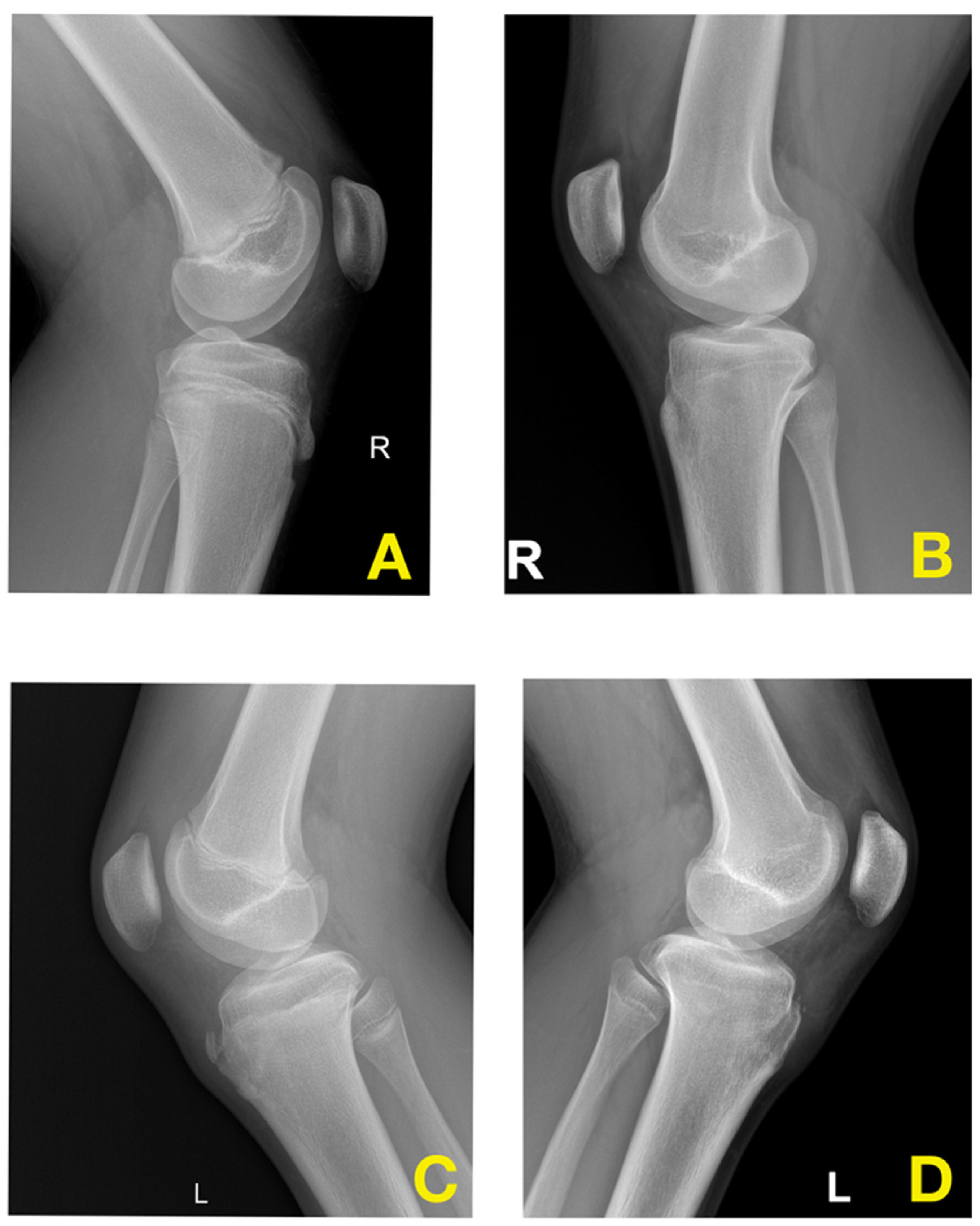 Jcm 13 04220 g003 Jcm 13 04220 g003