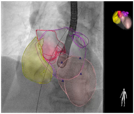 健康・医学 Perioperative Transesophageal Echocardio Basic Perioperative Transesophageal Echocardiography: Savage