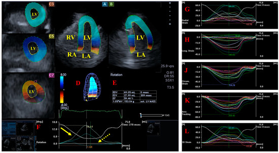Myocardial Mechanics and Valvular and Vascular Abnormalities