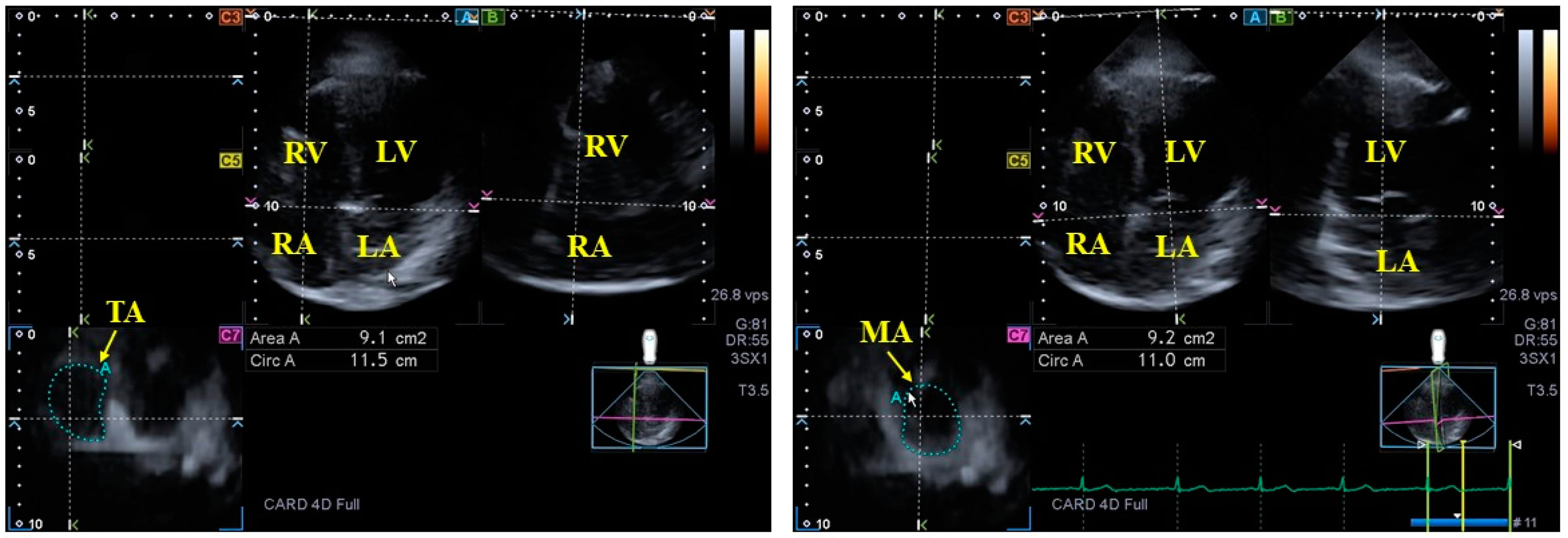 Jcm 13 04330 g004 Jcm 13 04330 g004