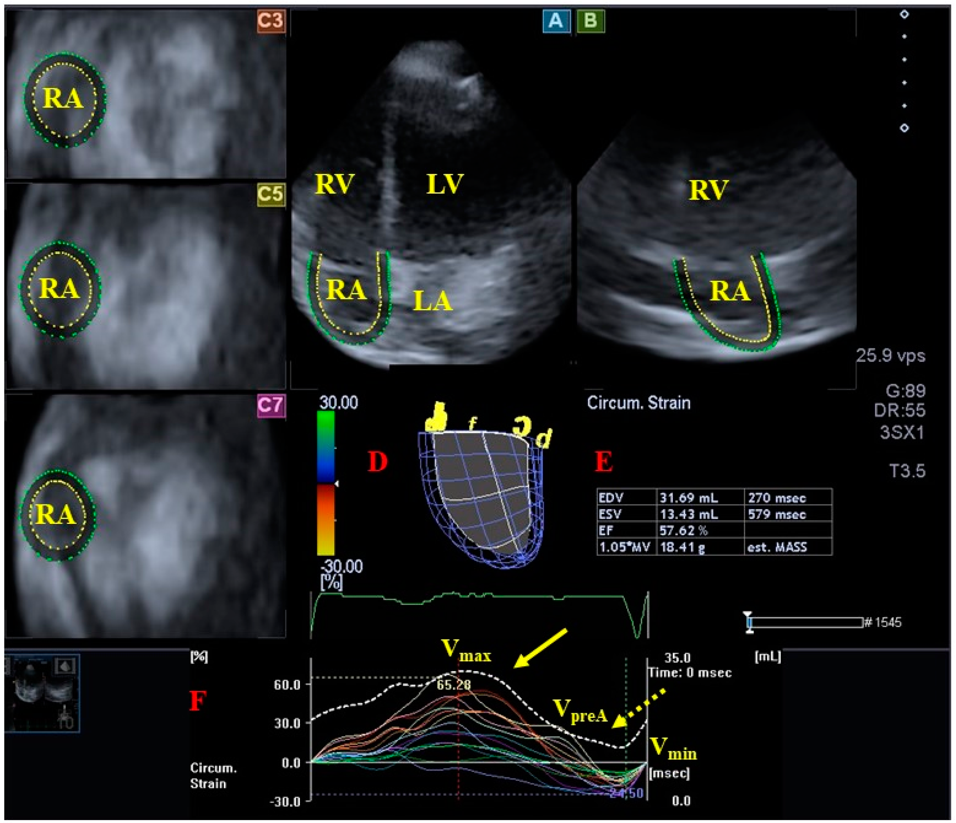 Jcm 13 04330 g005 Jcm 13 04330 g005