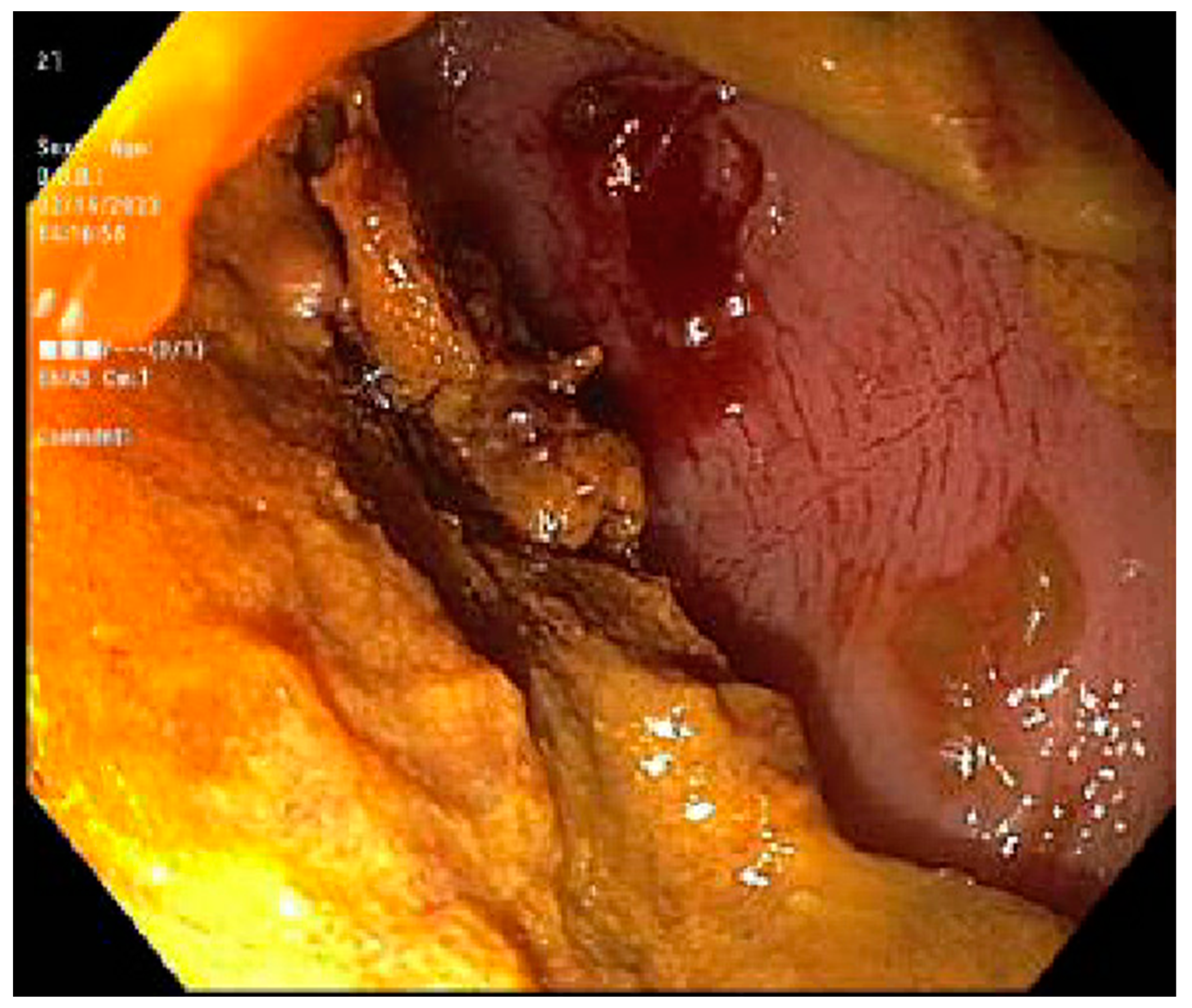 Jcm 13 04343 g004 Jcm 13 04343 g004