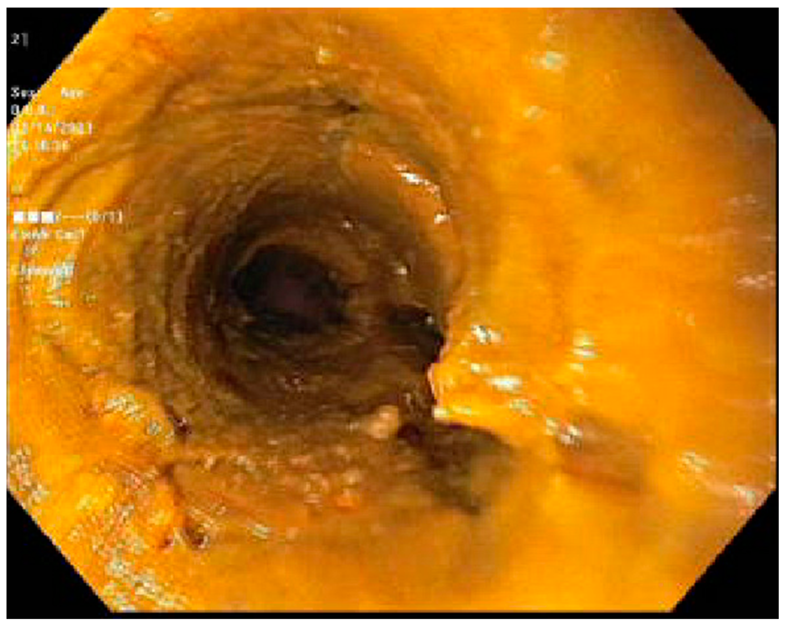 Jcm 13 04343 g005 Jcm 13 04343 g005