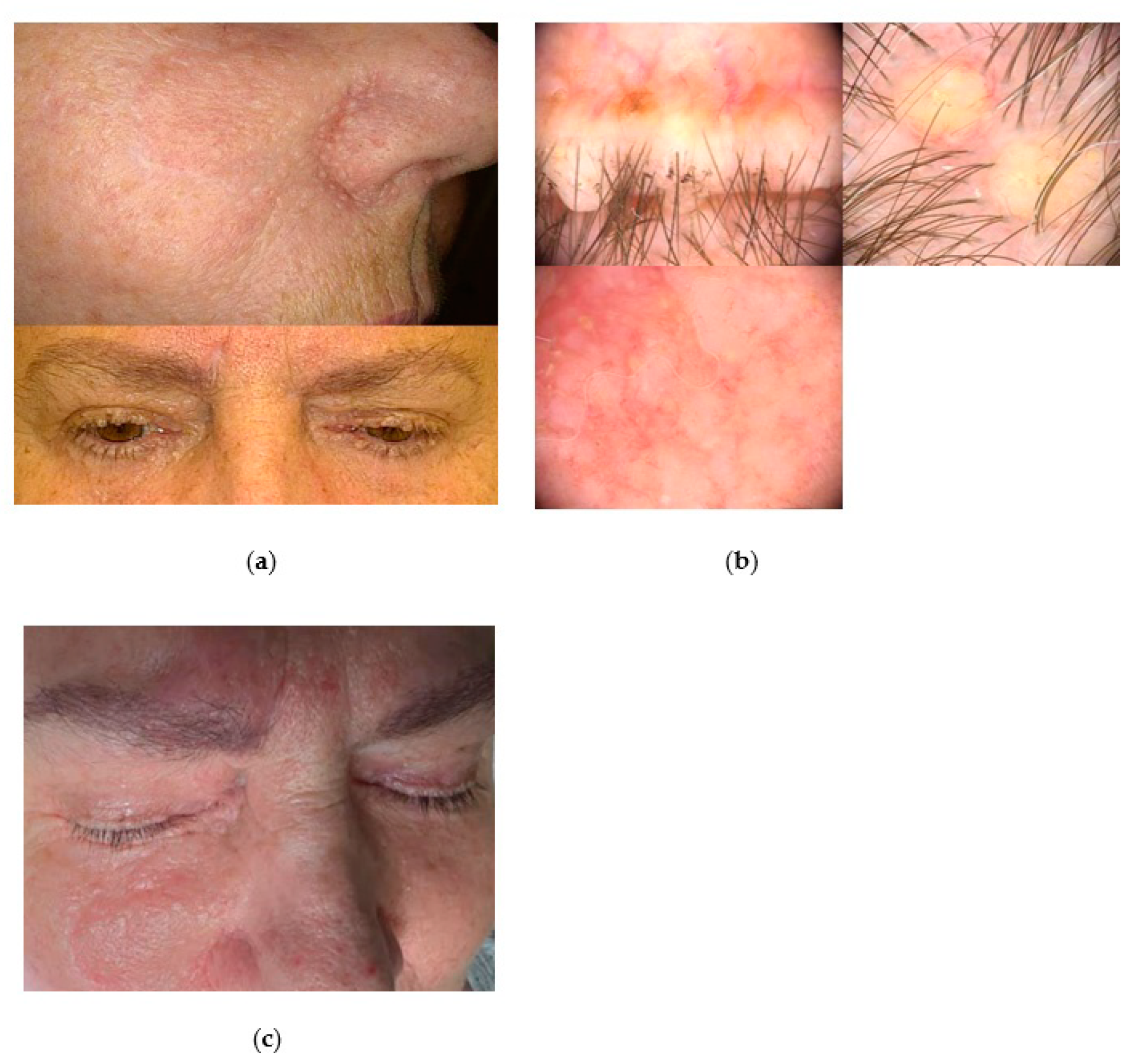 Jcm 13 04377 g003 Jcm 13 04377 g003