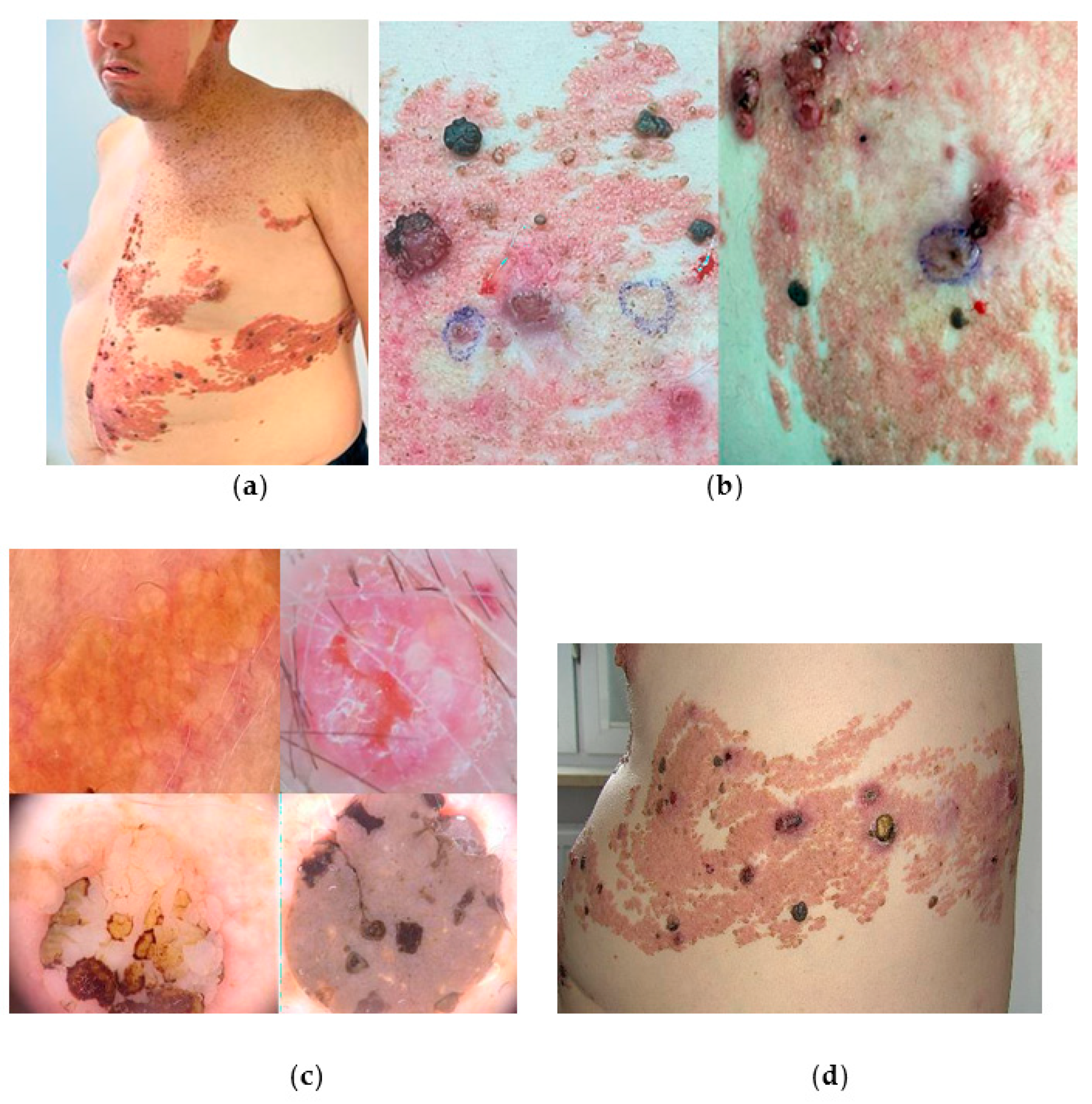 Jcm 13 04377 g004 Jcm 13 04377 g004