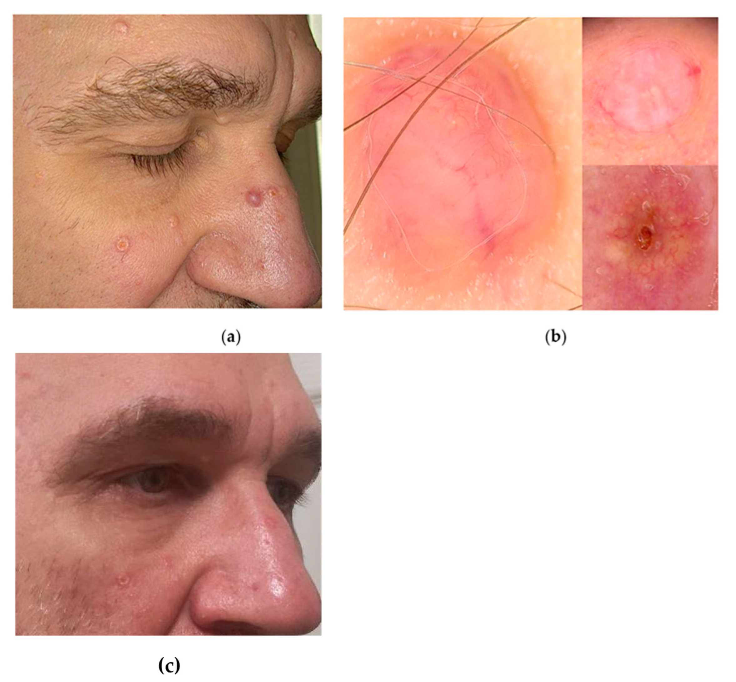 Jcm 13 04377 g005 Jcm 13 04377 g005