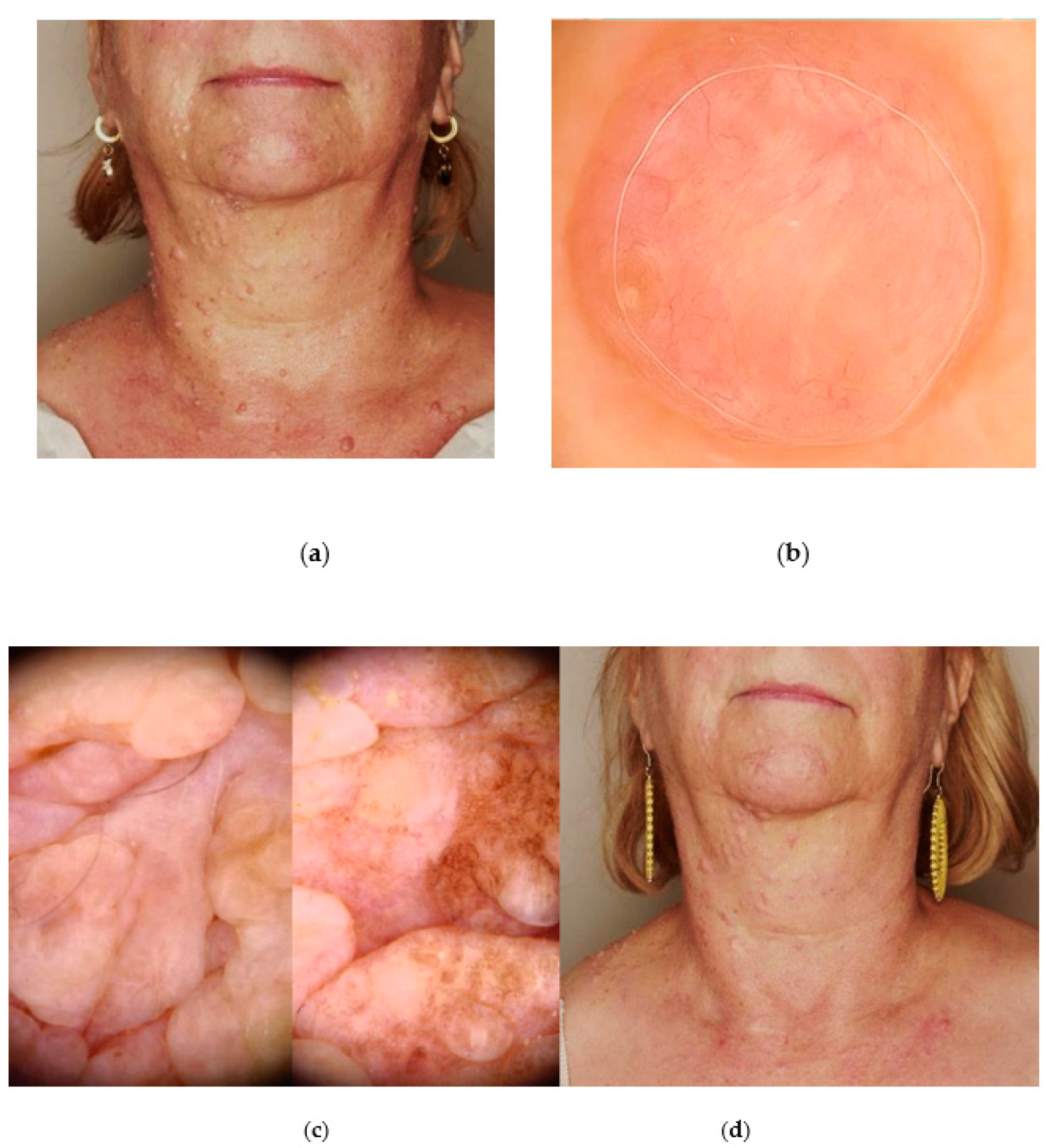 Jcm 13 04377 g006 Jcm 13 04377 g006