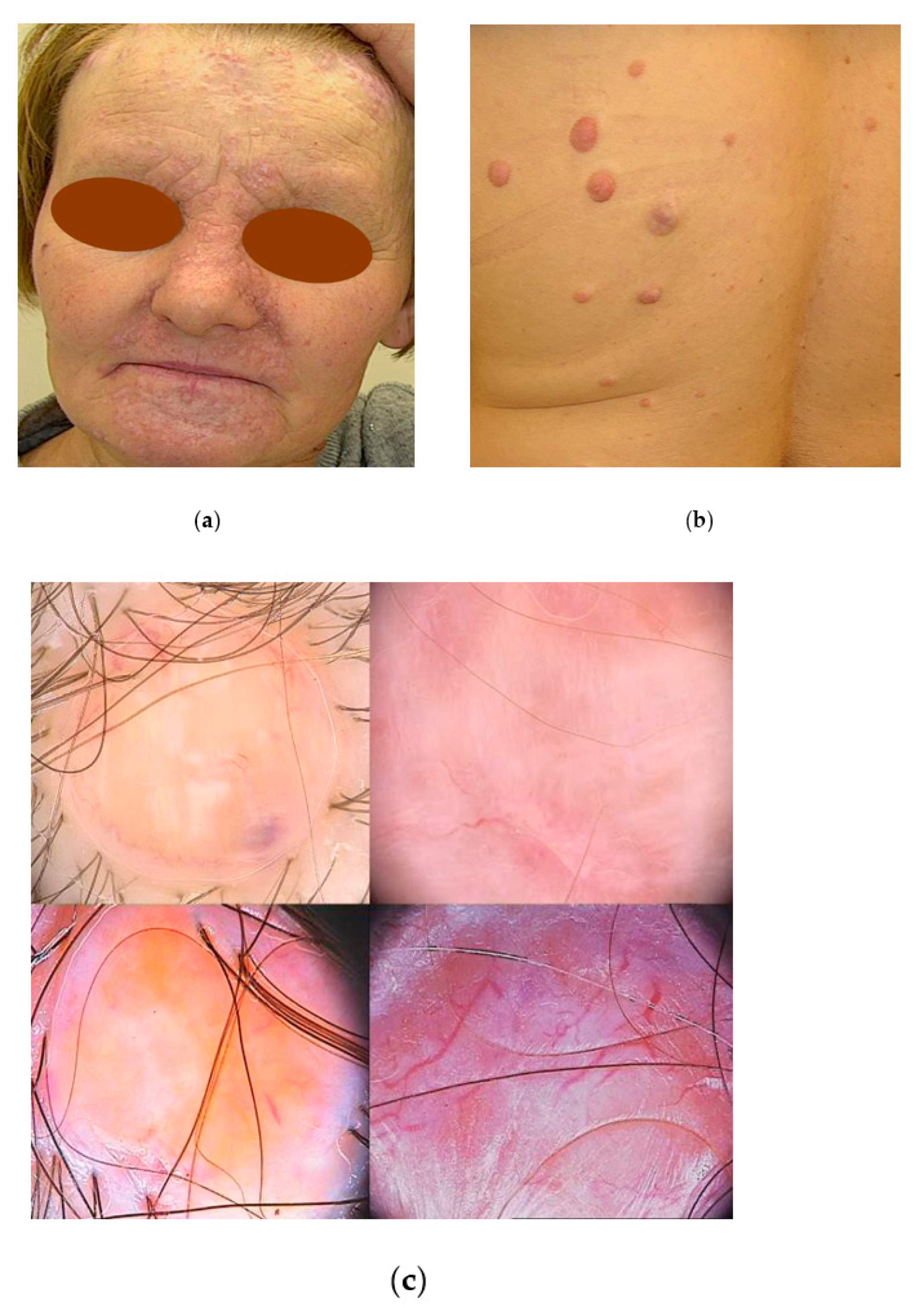 Jcm 13 04377 g007 Jcm 13 04377 g007