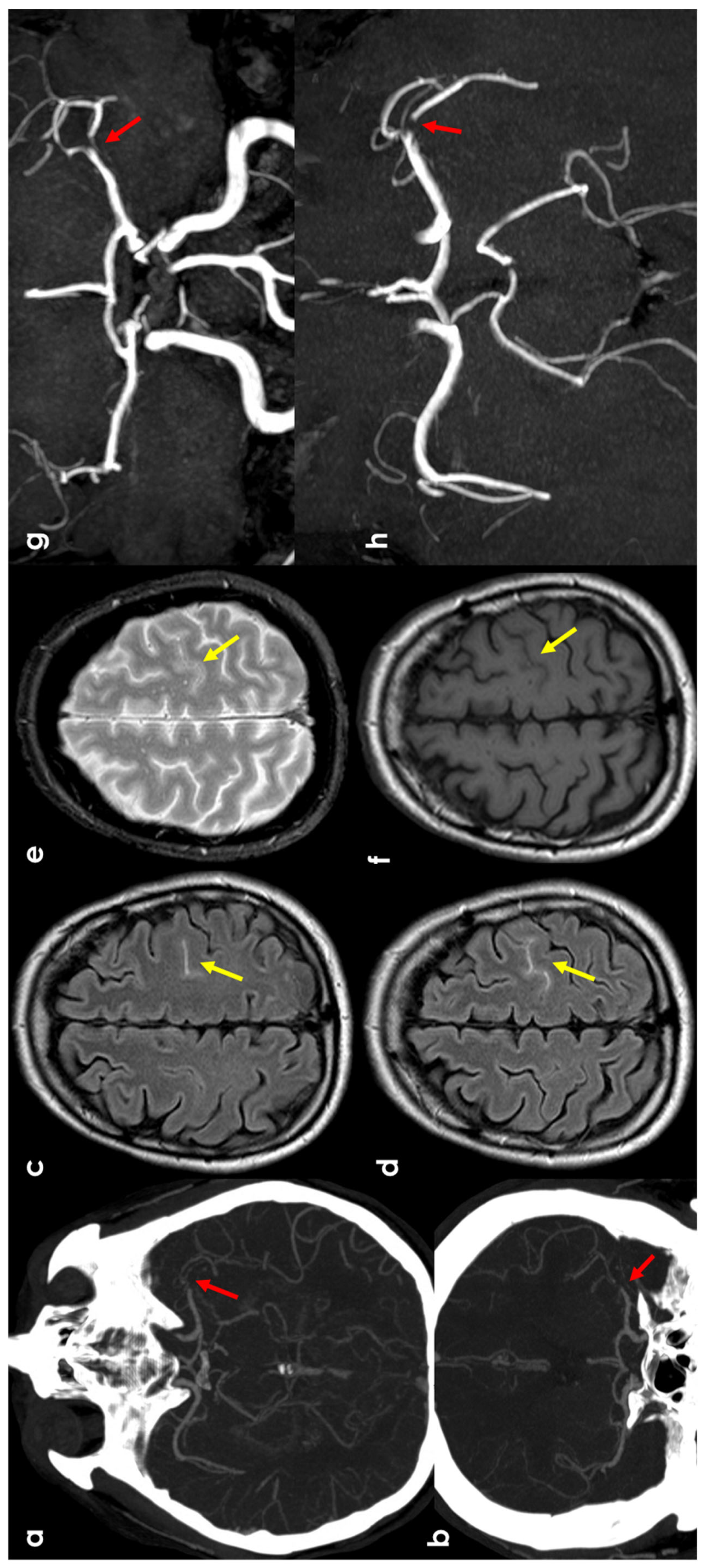 Jcm 13 04382 g002 Jcm 13 04382 g002