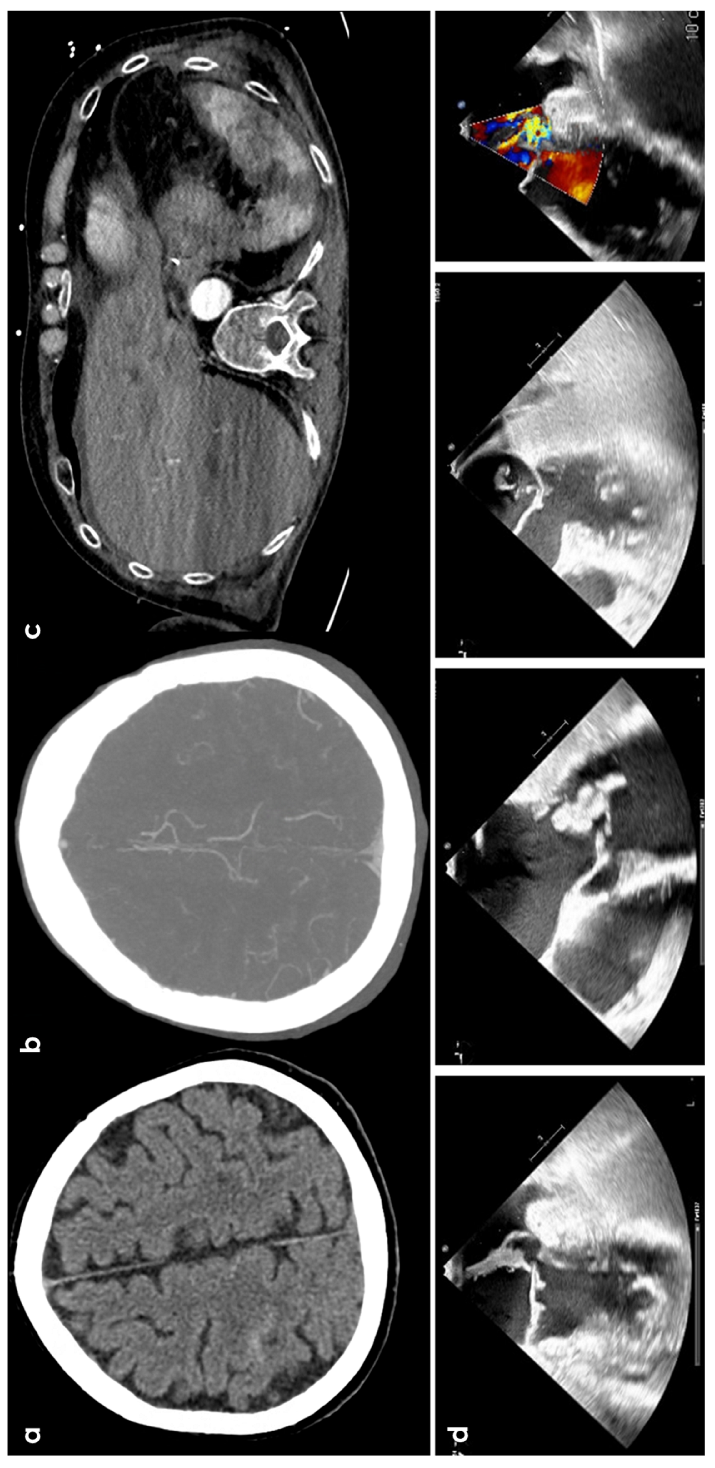Jcm 13 04382 g003 Jcm 13 04382 g003