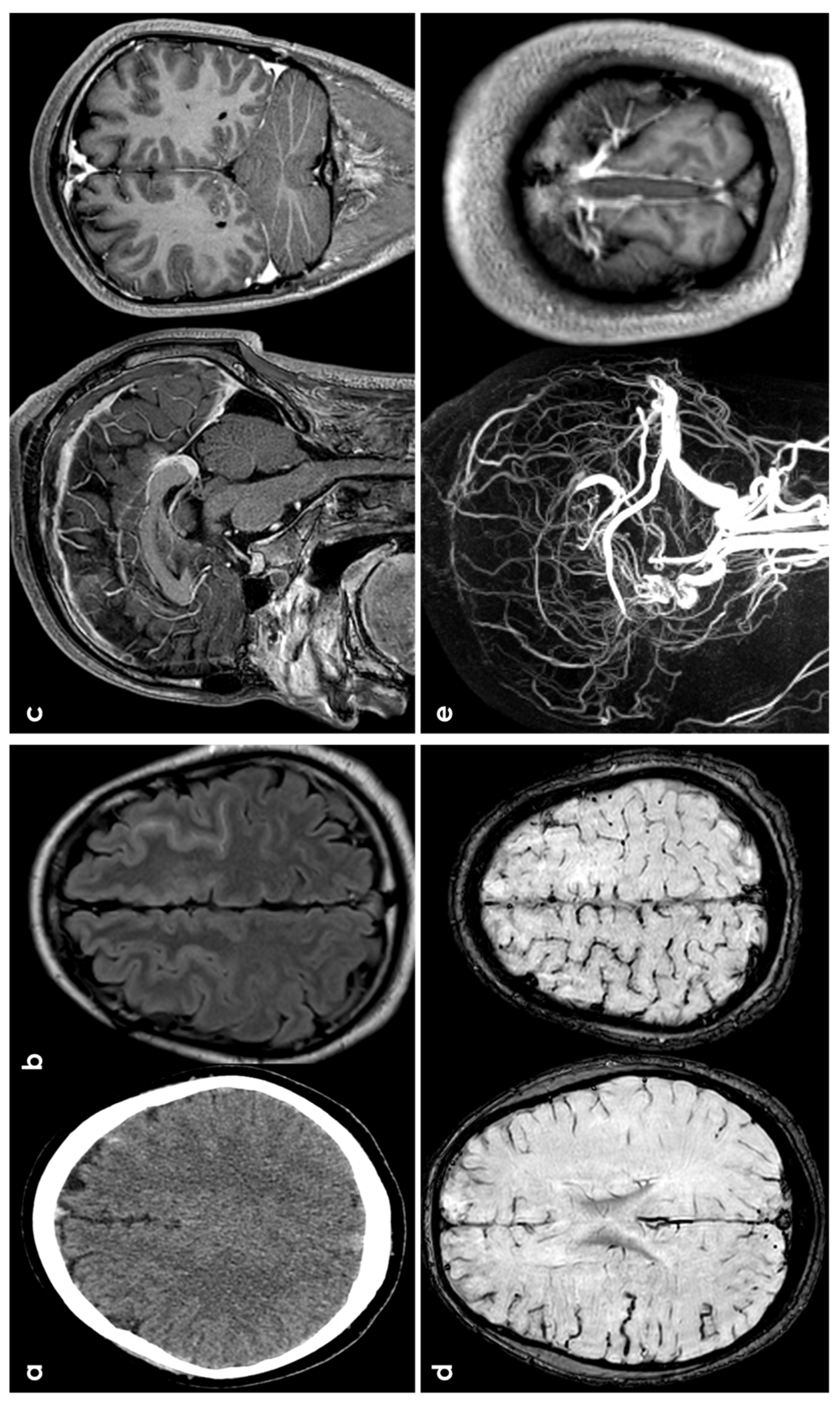 Jcm 13 04382 g004 Jcm 13 04382 g004