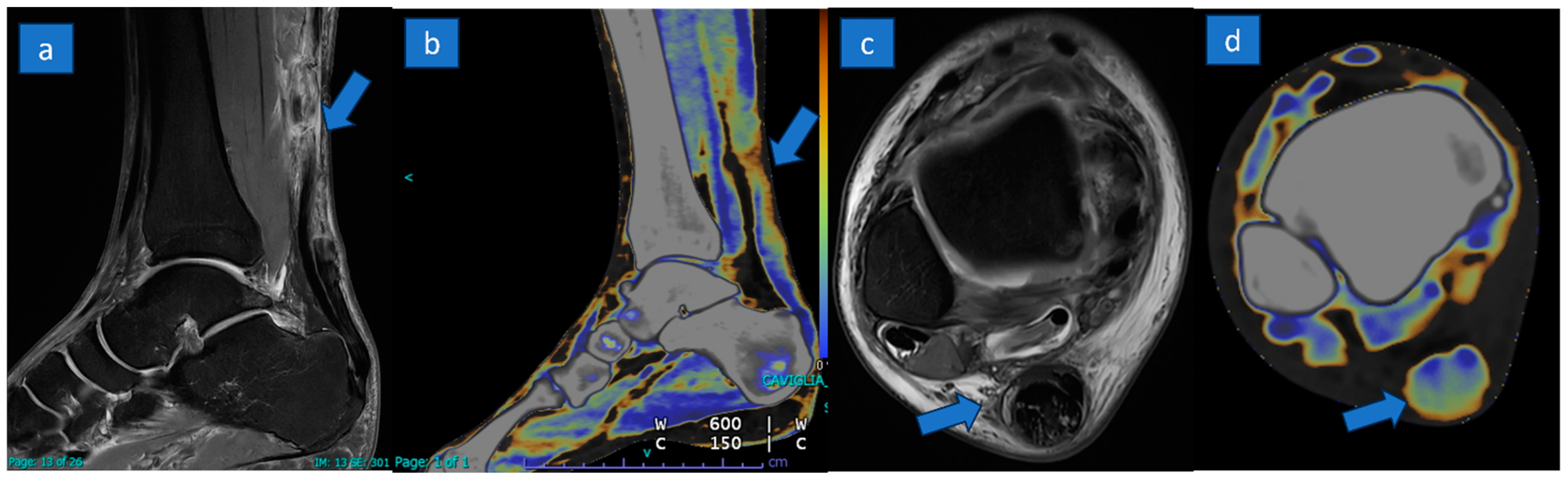 Jcm 13 04426 g003 Jcm 13 04426 g003