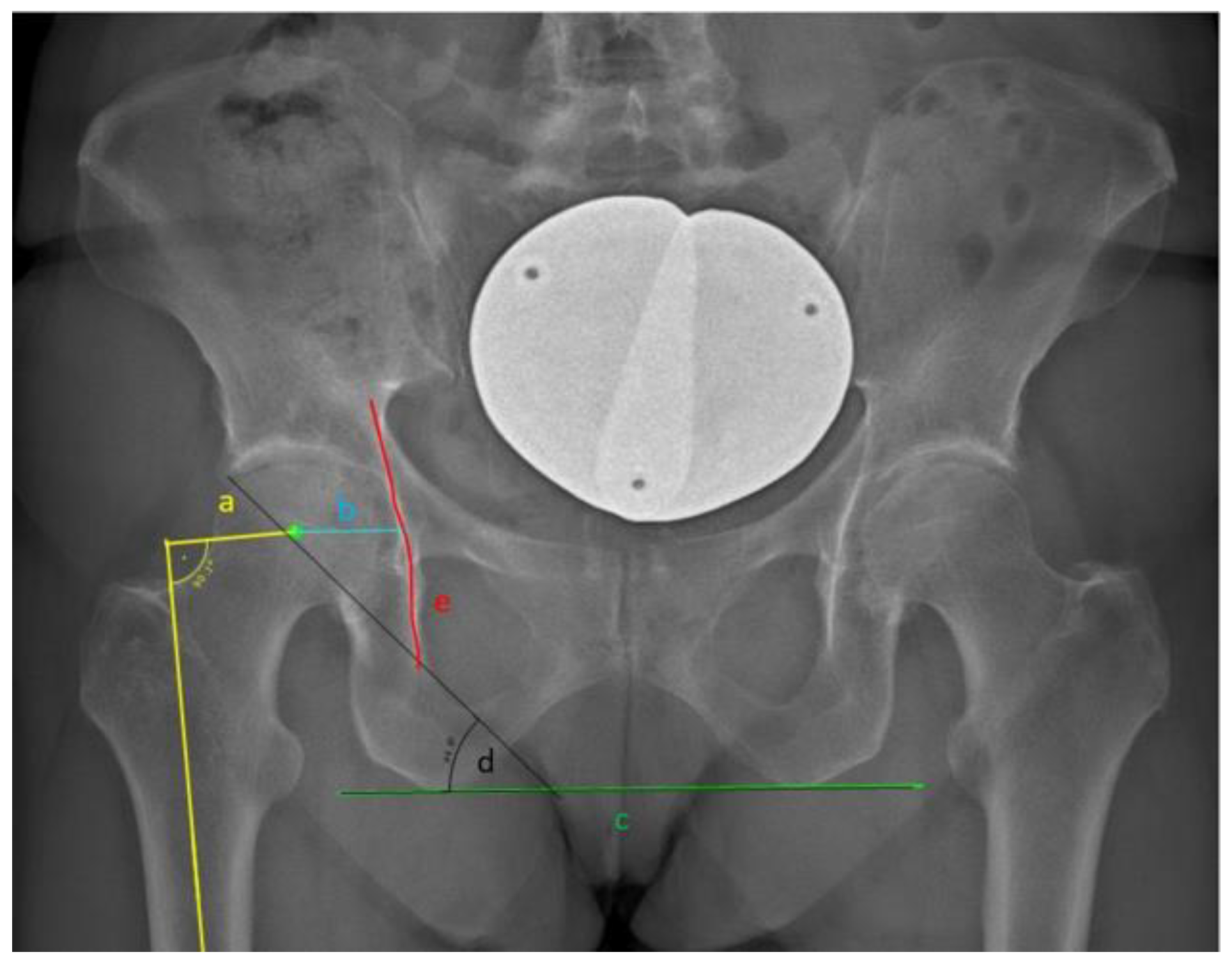 Jcm 13 04453 g001 Jcm 13 04453 g001