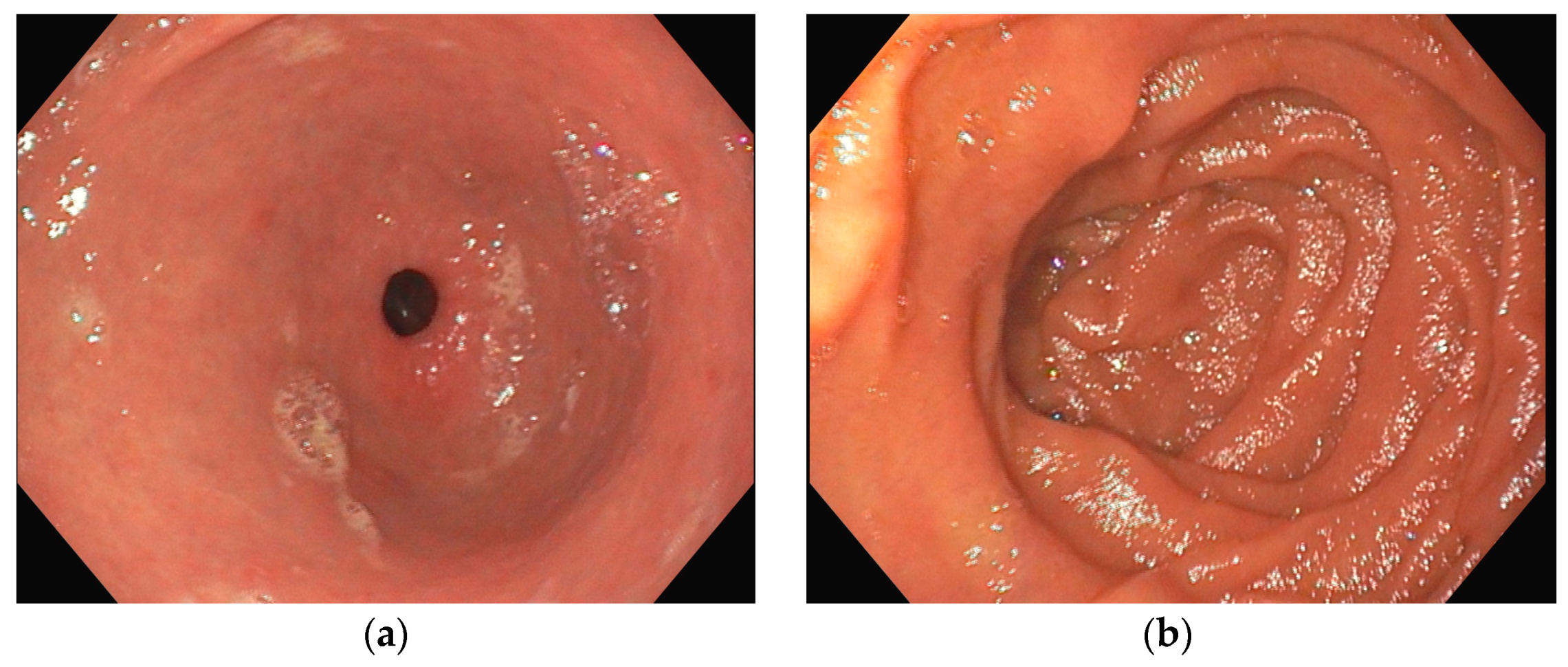 Jcm 13 04515 g002 Jcm 13 04515 g002