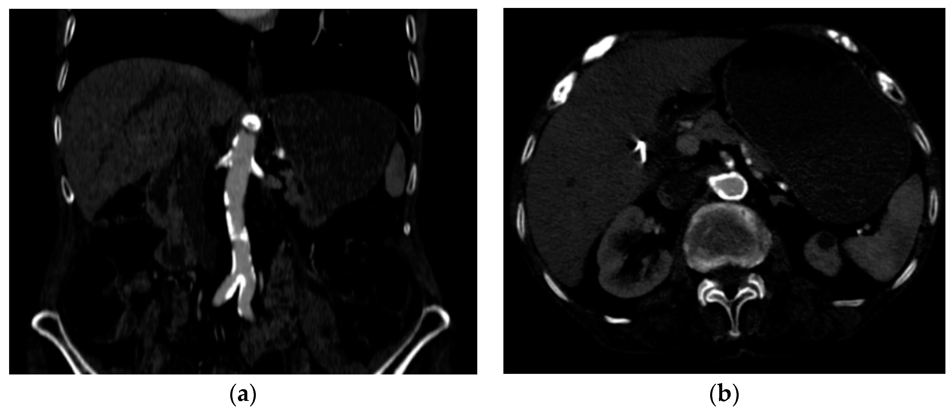 Jcm 13 04515 g003 Jcm 13 04515 g003