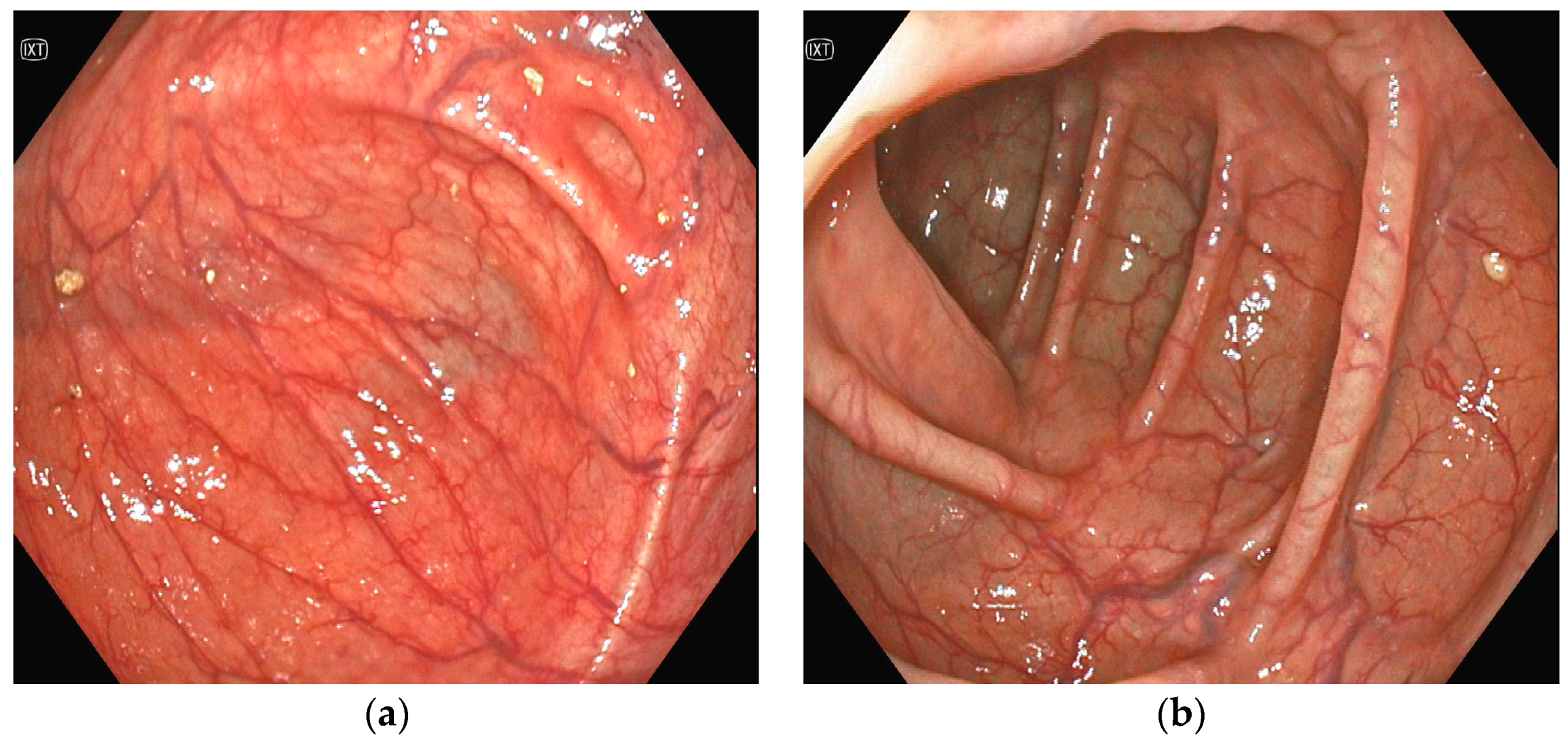 Jcm 13 04515 g004 Jcm 13 04515 g004