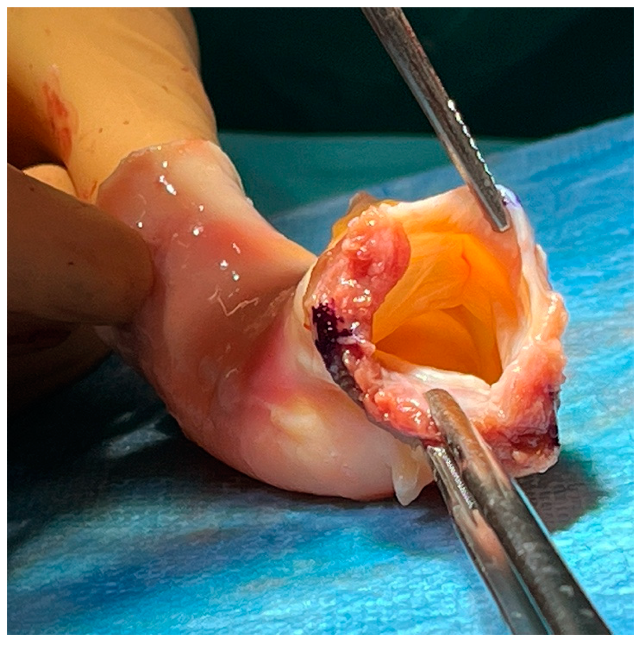 Jcm 13 04532 g001 Jcm 13 04532 g001