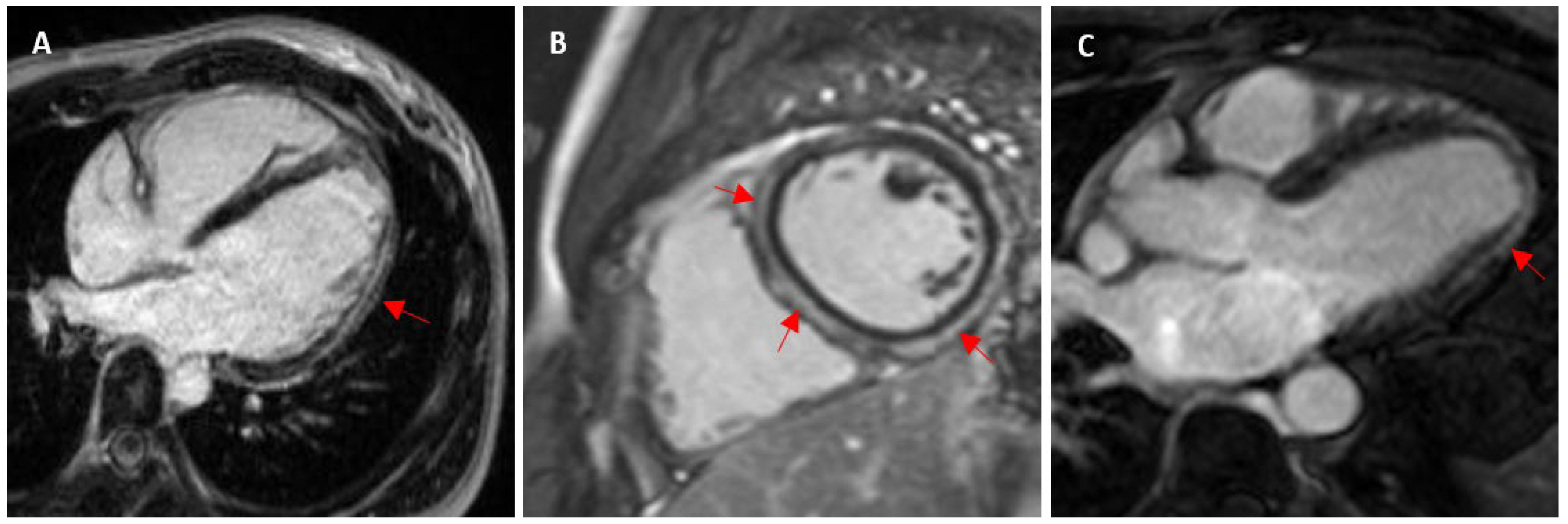 Jcm 13 04536 g006 Jcm 13 04536 g006