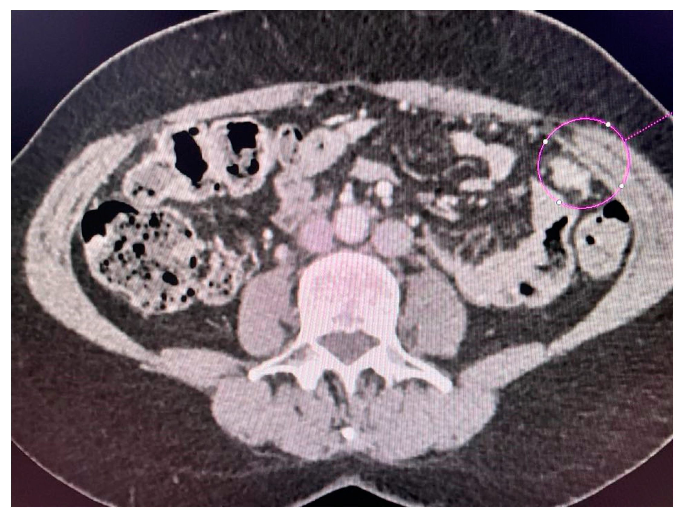 Jcm 13 04560 g004 Jcm 13 04560 g004