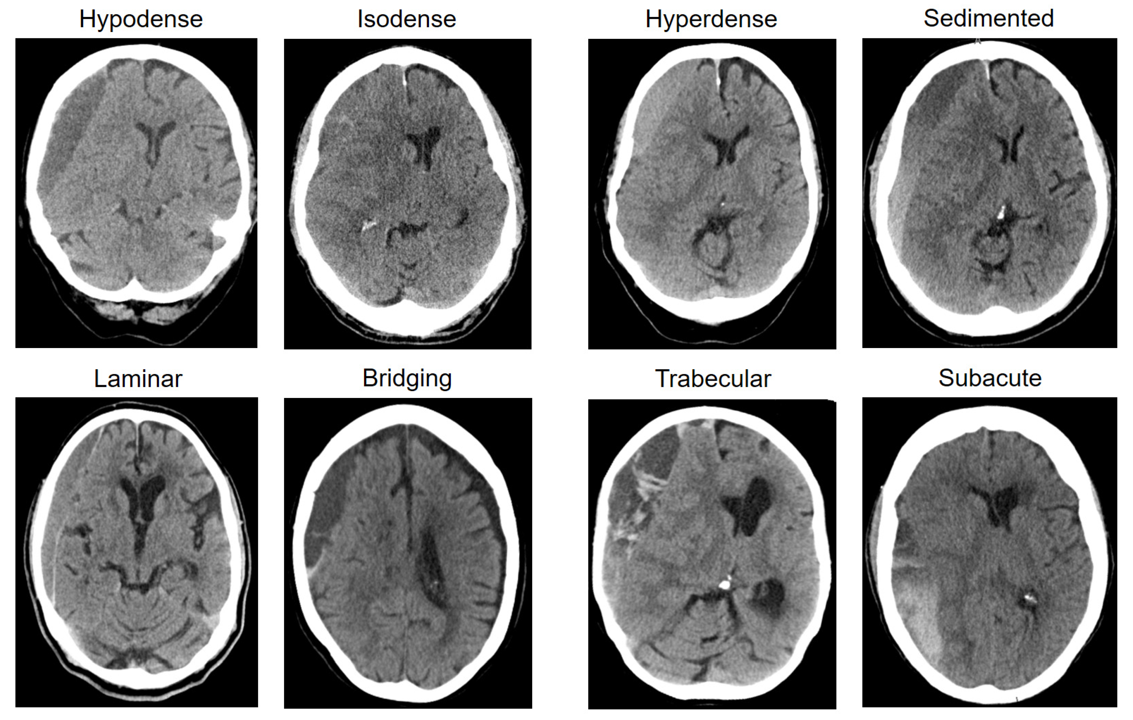 Jcm 13 04591 g001 Jcm 13 04591 g001