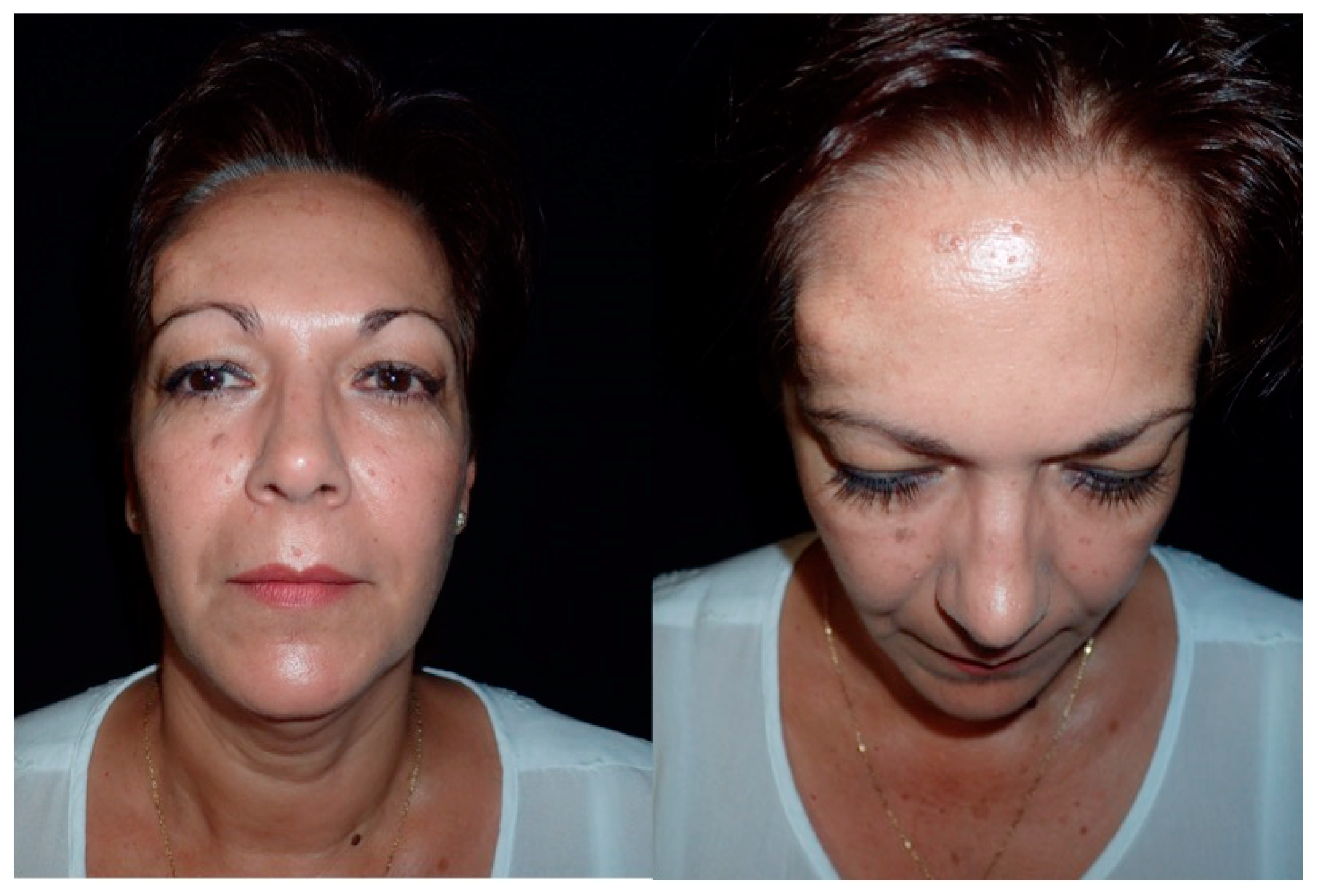 Jcm 13 04602 g001 Jcm 13 04602 g001