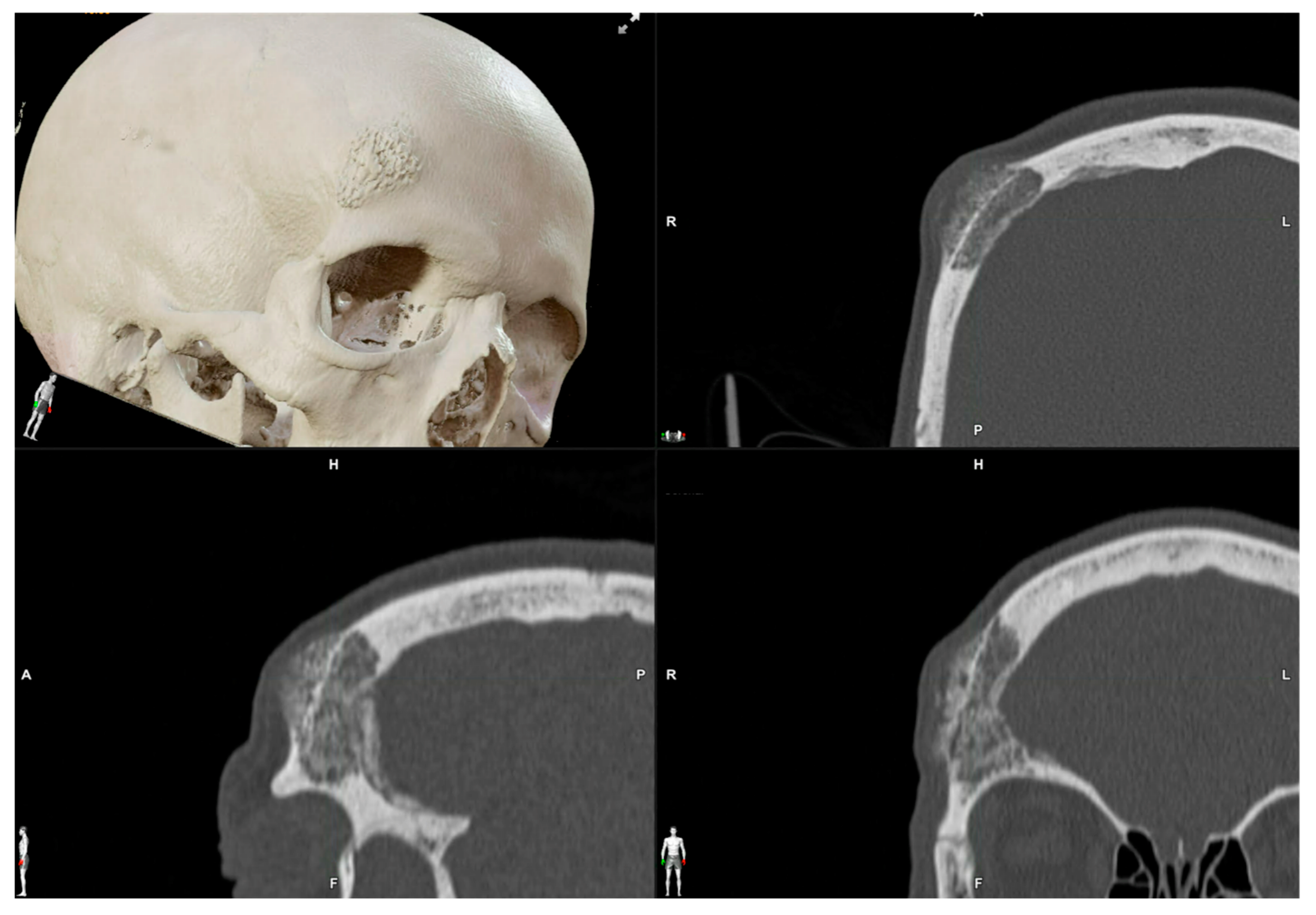 Jcm 13 04602 g002 Jcm 13 04602 g002