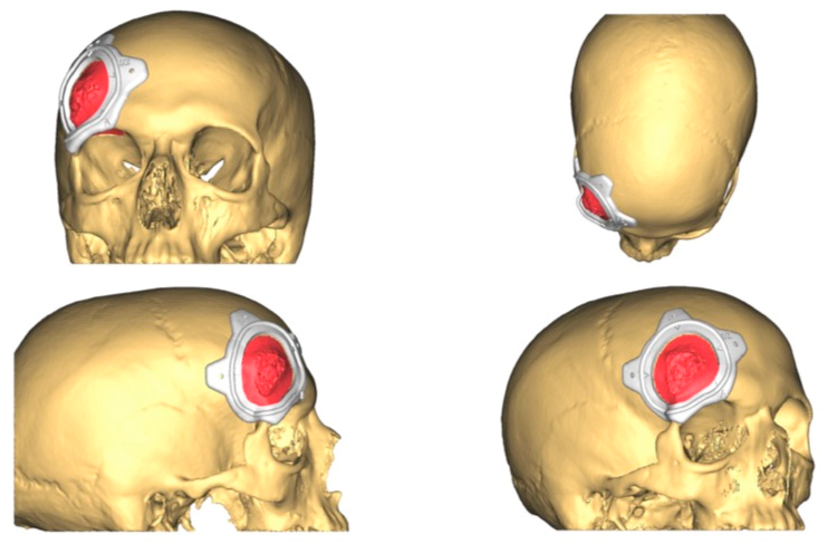 Jcm 13 04602 g003 Jcm 13 04602 g003