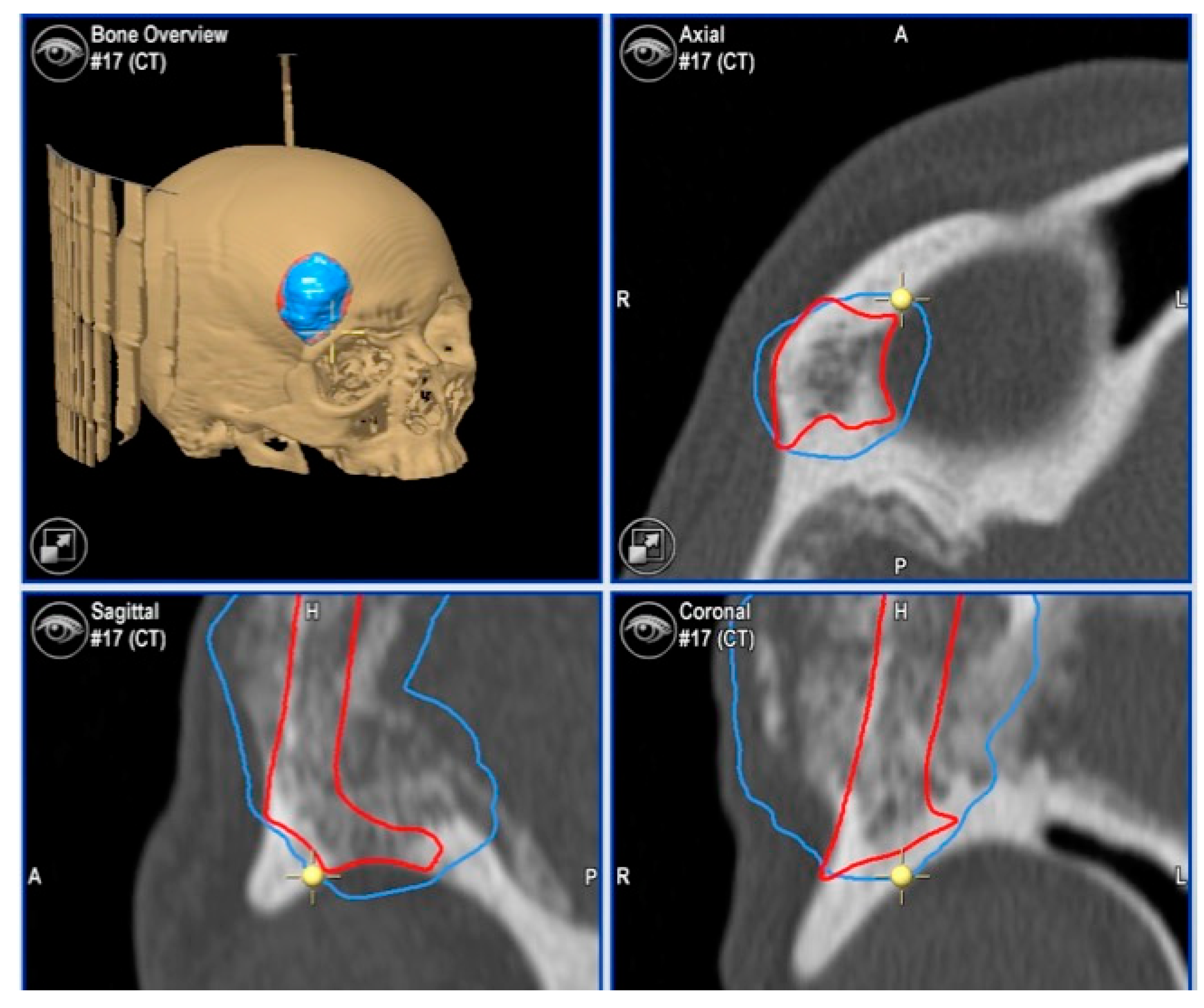 Jcm 13 04602 g007 Jcm 13 04602 g007