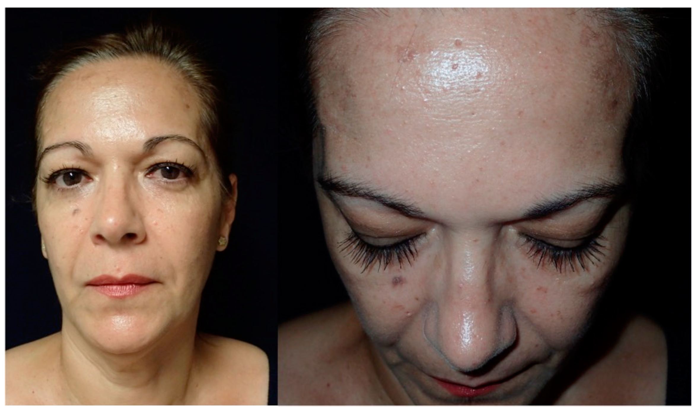 Jcm 13 04602 g009 Jcm 13 04602 g009