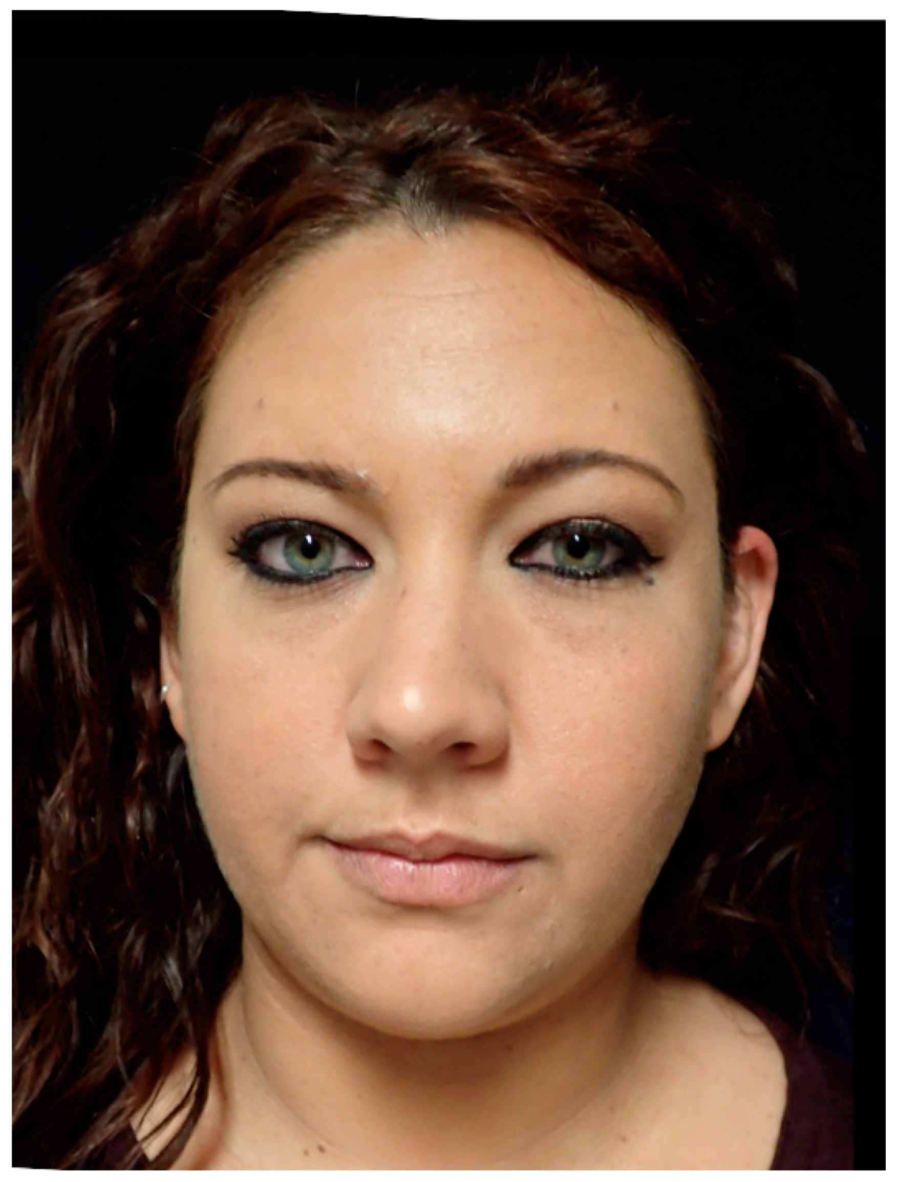 Jcm 13 04602 g010 Jcm 13 04602 g010