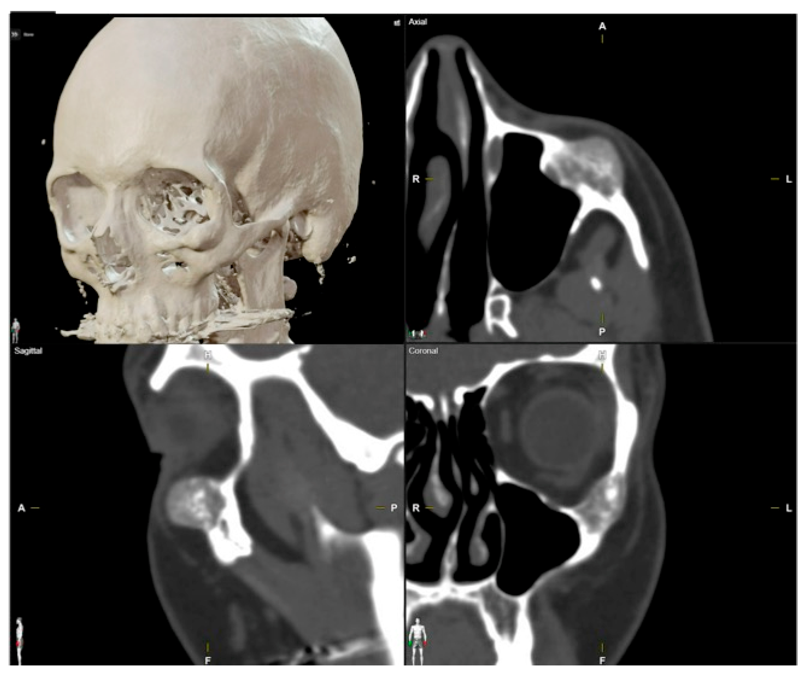Jcm 13 04602 g011 Jcm 13 04602 g011