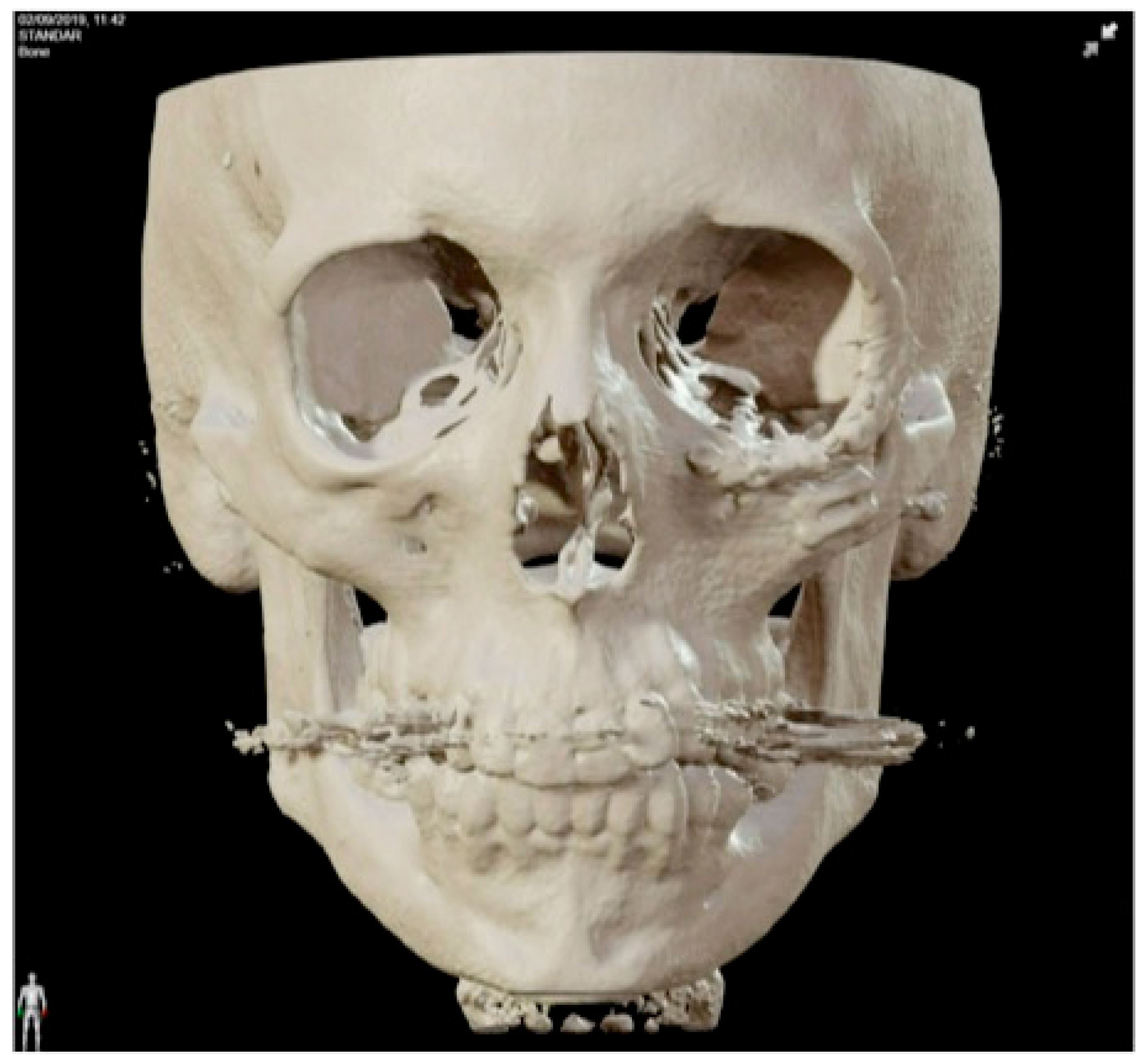 Jcm 13 04602 g017 Jcm 13 04602 g017