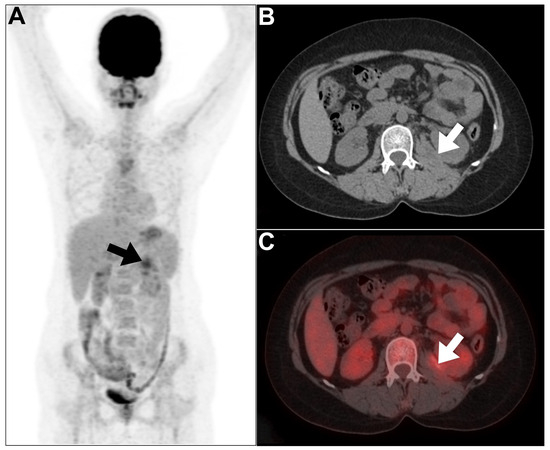 A New Era for PET/CT: Applications in Non-Tumorous Renal Pathologies