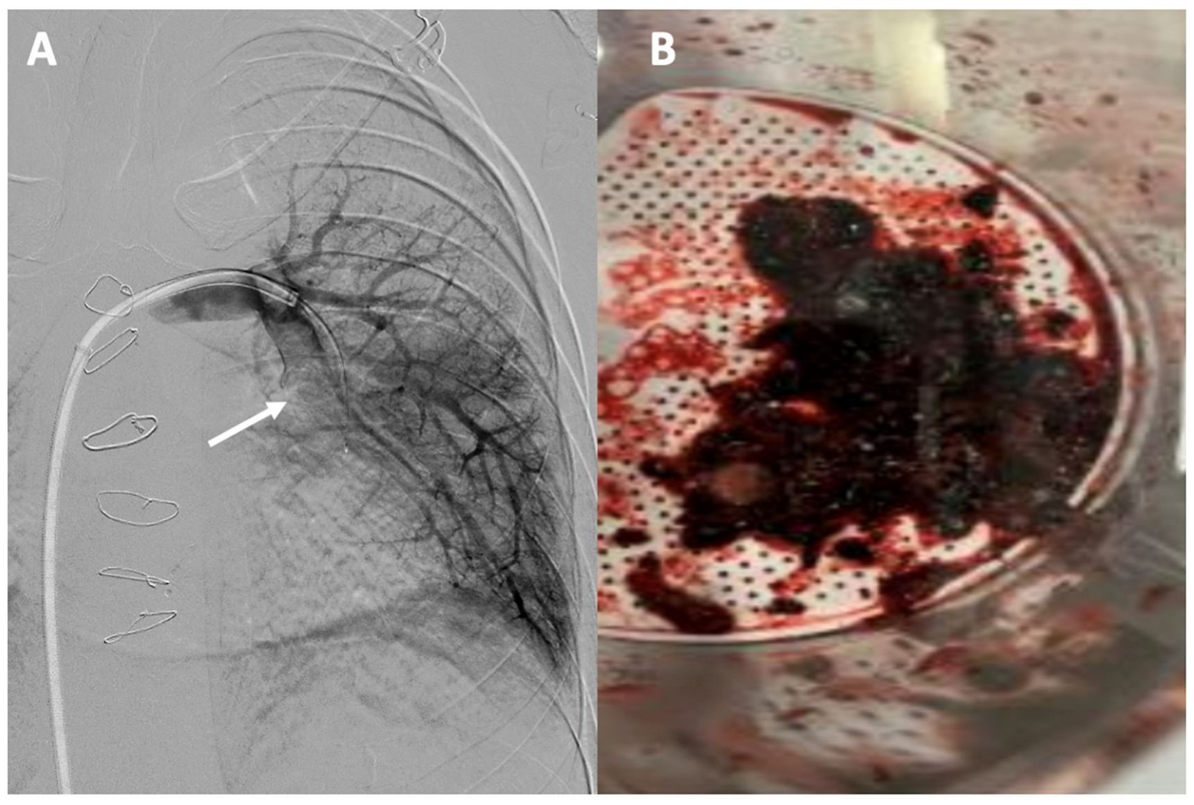 Jcm 13 04633 g006 Jcm 13 04633 g006