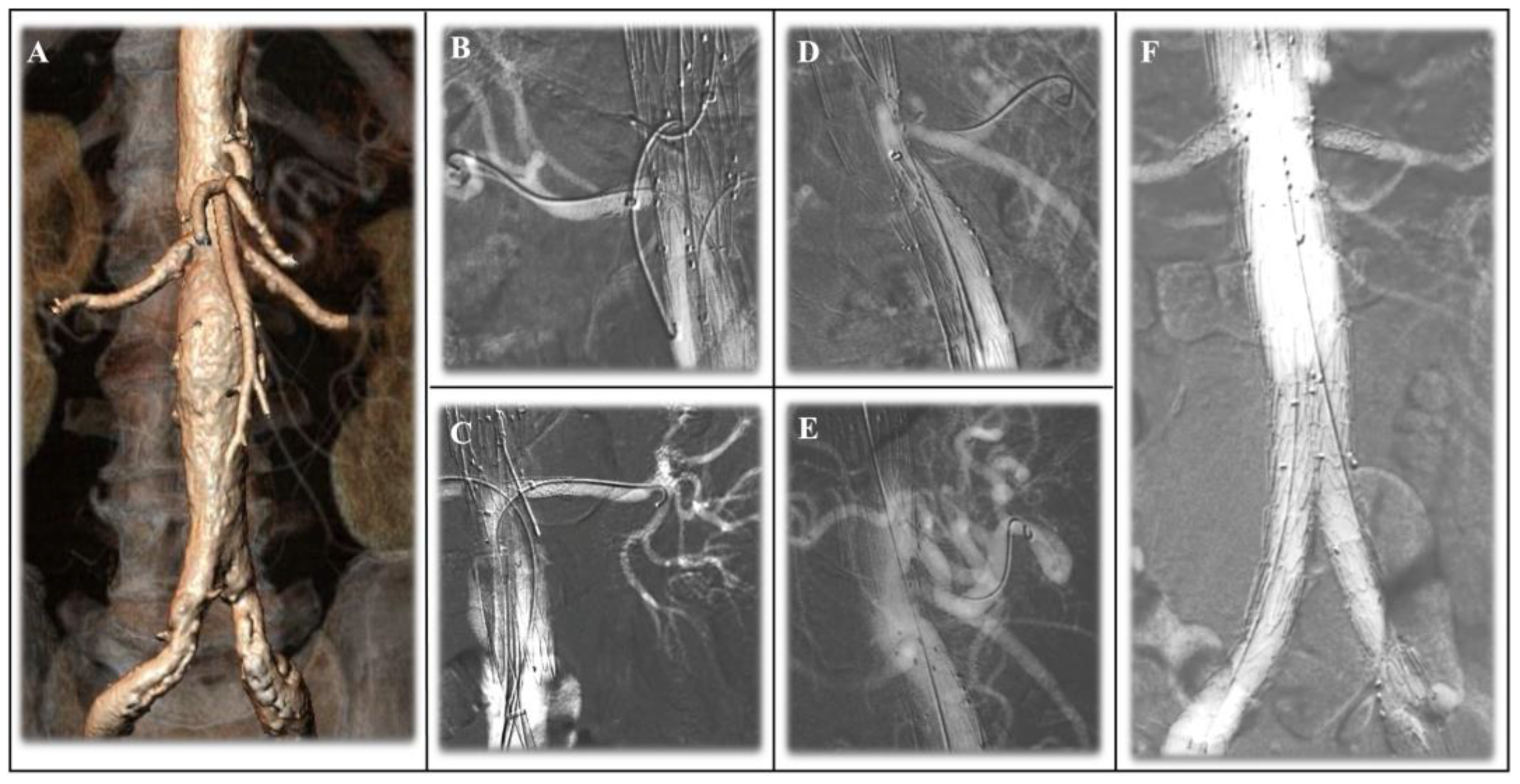 Jcm 13 04634 g005 Jcm 13 04634 g005