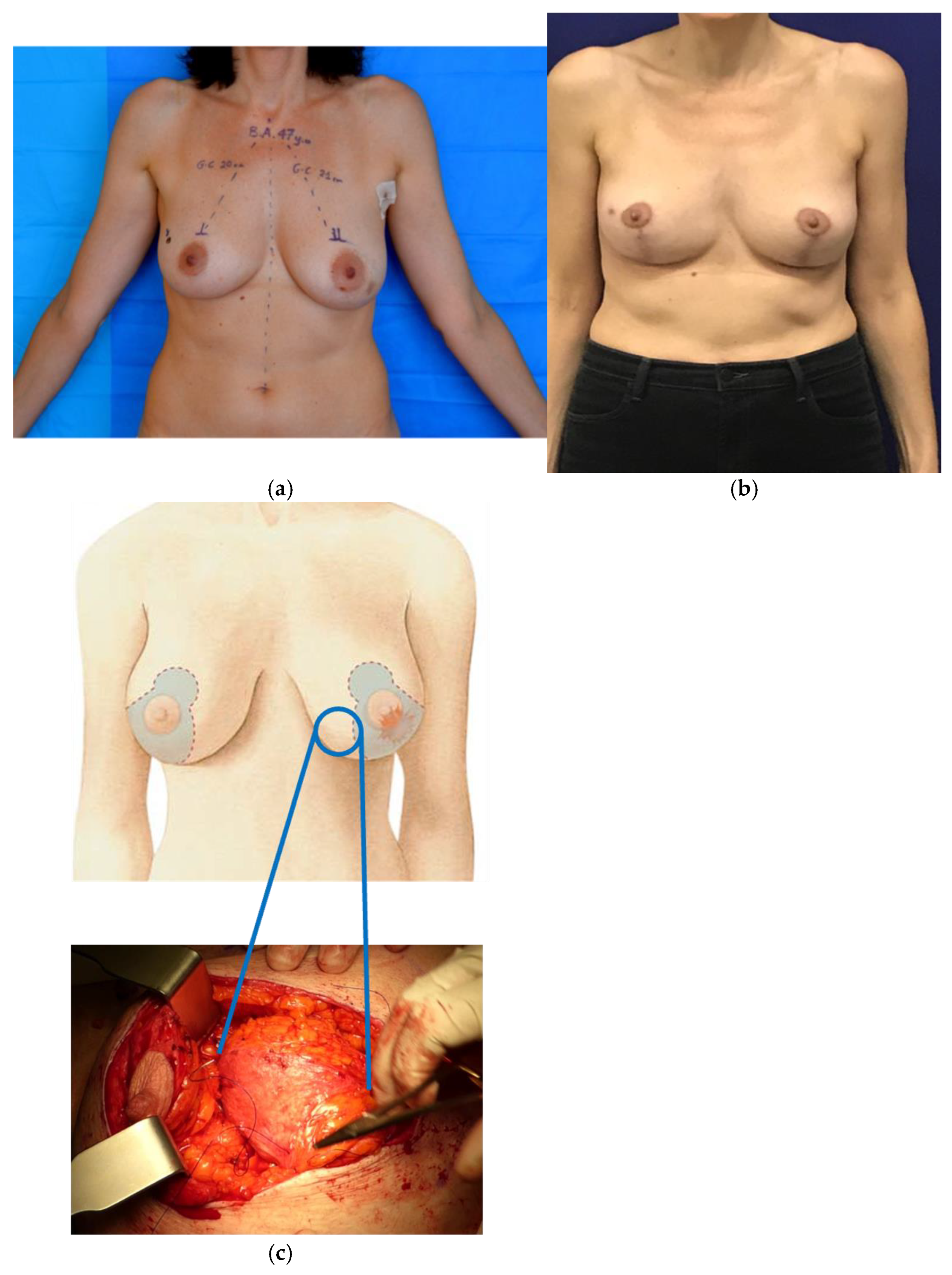 Jcm 13 04718 g002 Jcm 13 04718 g002