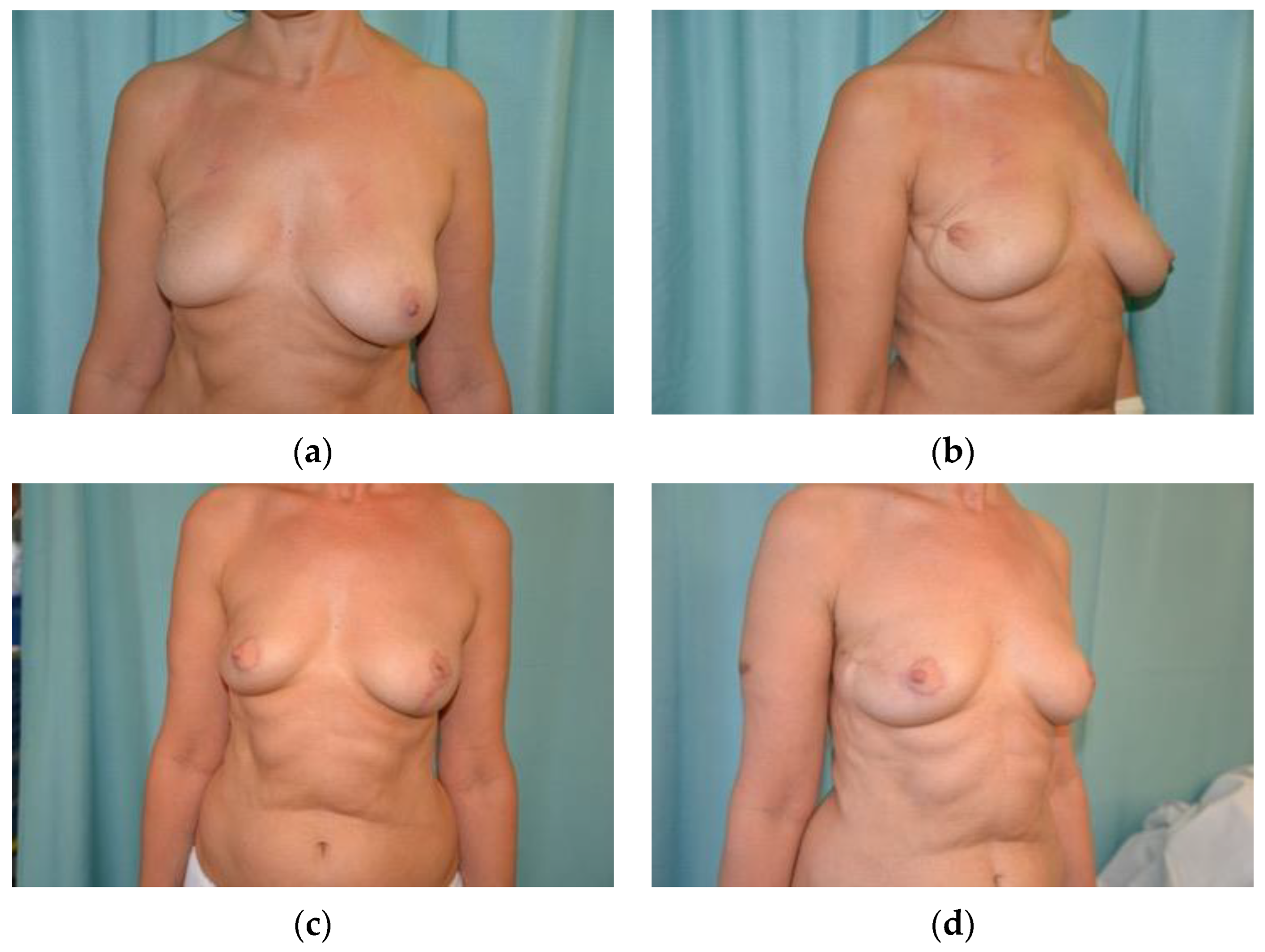 Jcm 13 04718 g003 Jcm 13 04718 g003