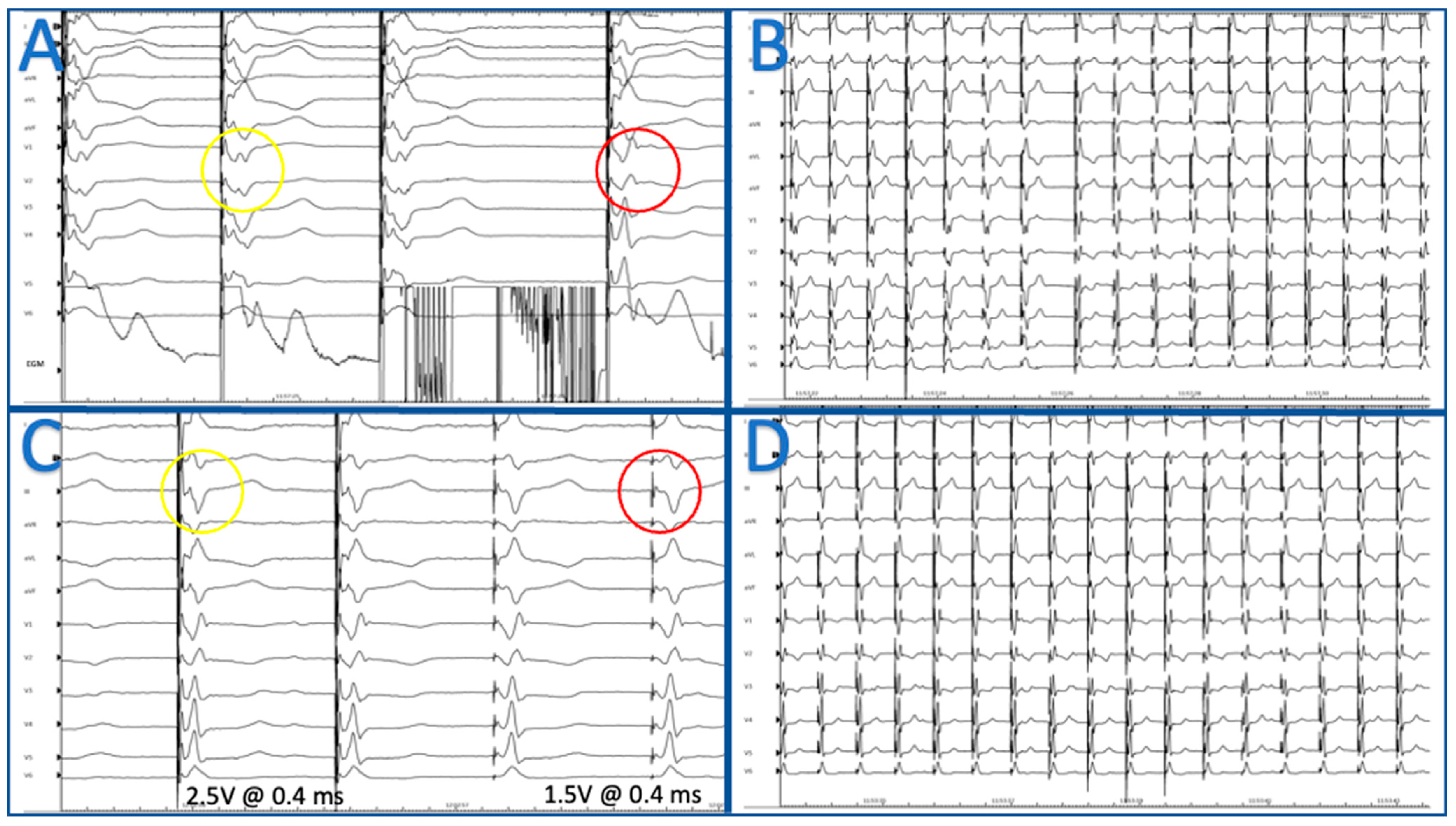 CardiacPICUスタンダード Cardiac PICU スタンダード | 日本小児循環器集中治療研究会 |本