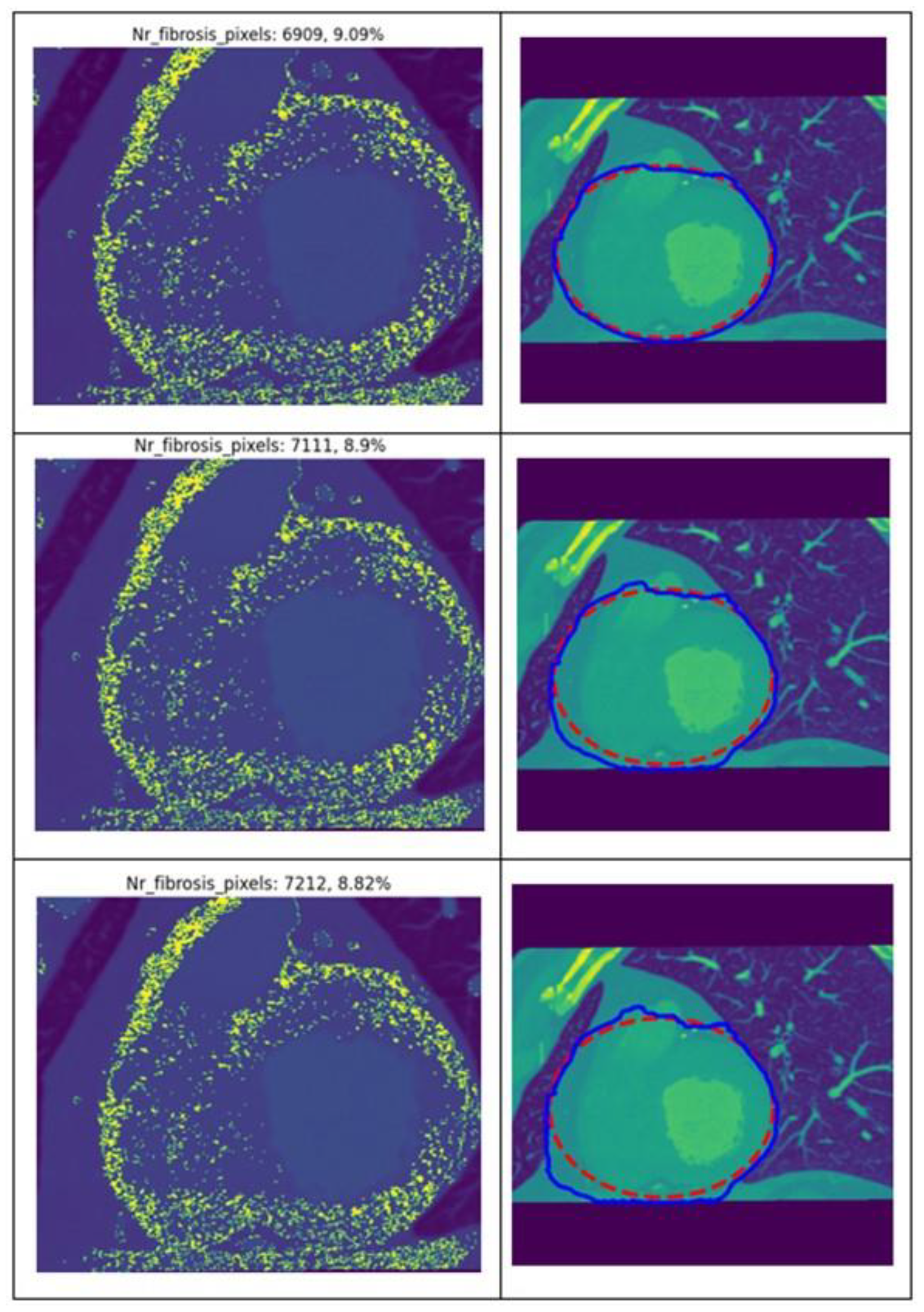 Jcm 13 04807 g003 Jcm 13 04807 g003