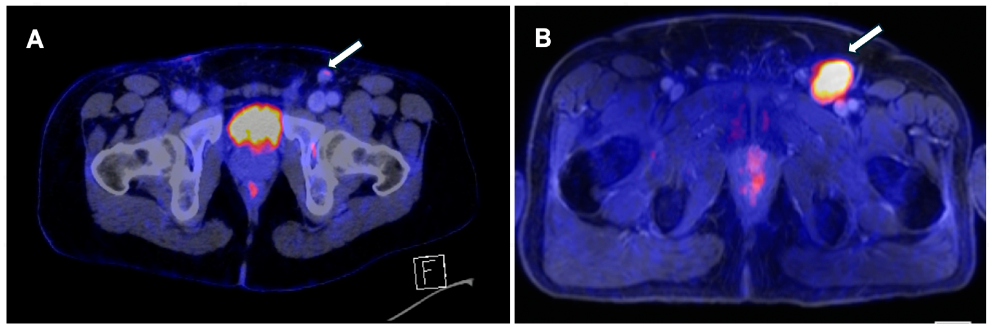 JCM | Free Full-Text | Current Role of PET CT in Staging and Management ...