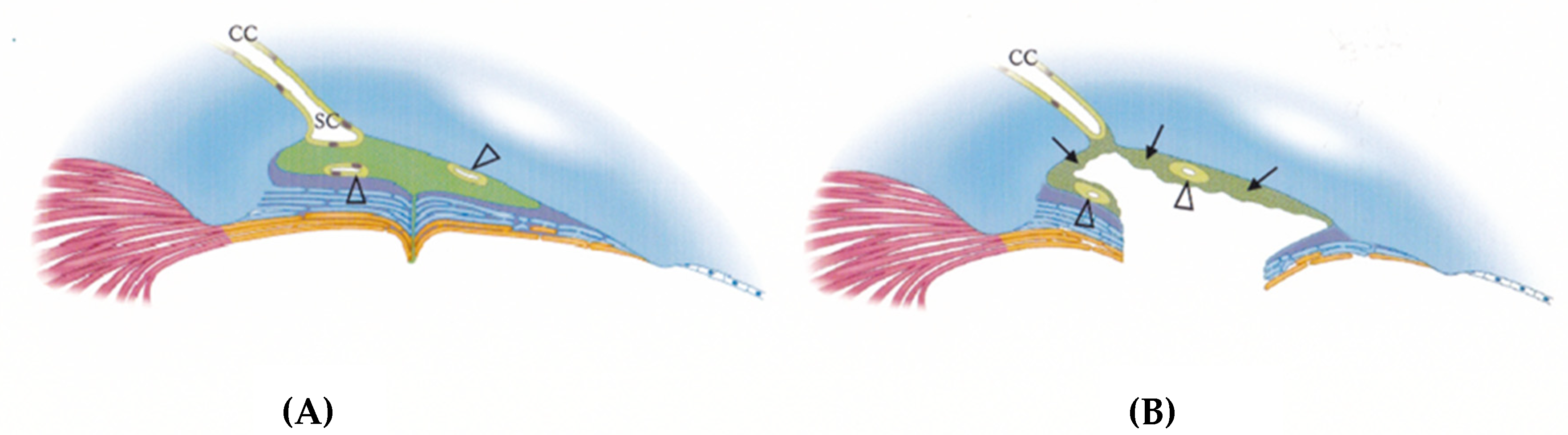 Jcm 13 04882 g001 Jcm 13 04882 g001