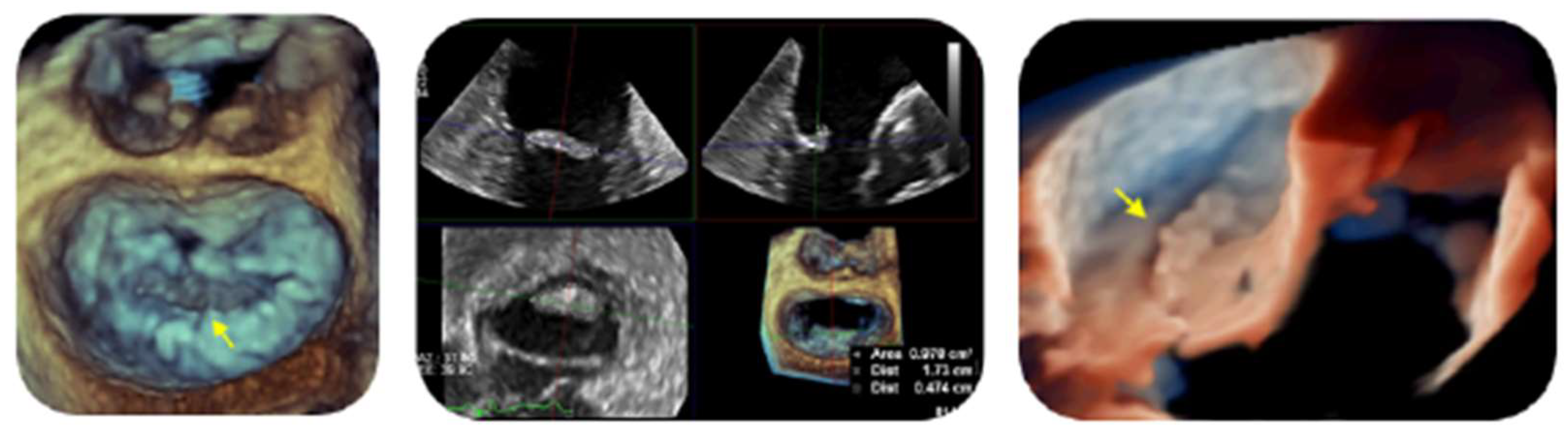 Jcm 13 04904 g005