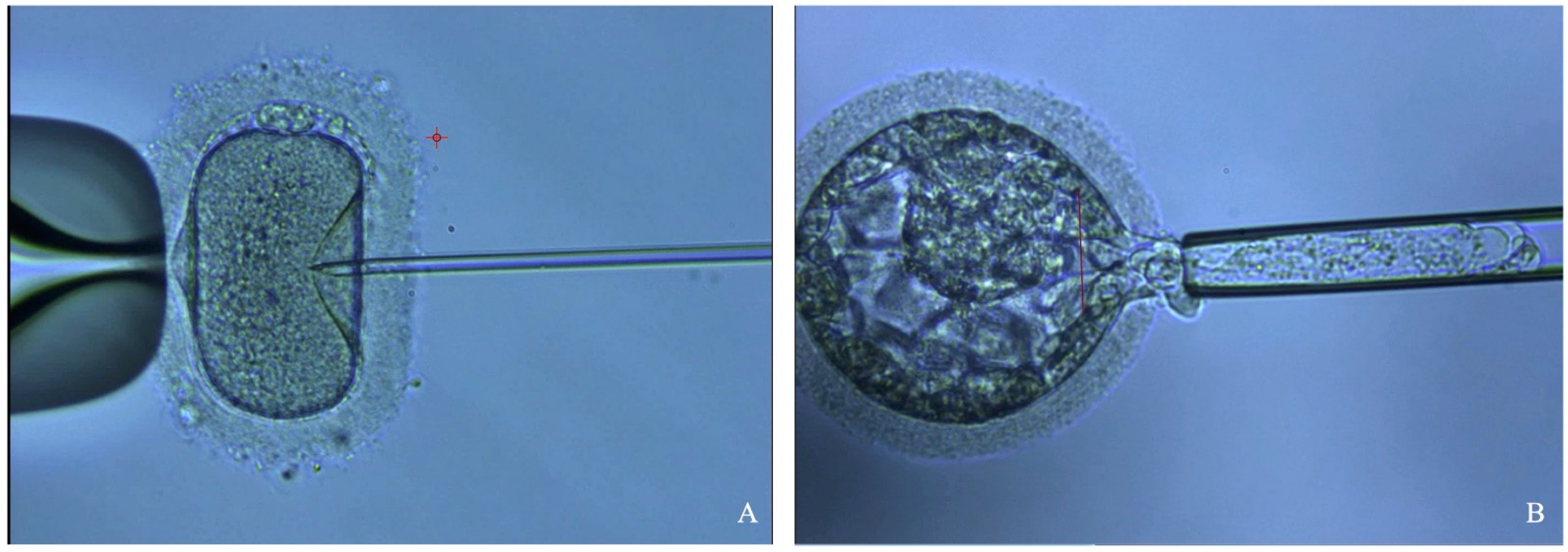 Jcm 13 04939 g002 Jcm 13 04939 g002