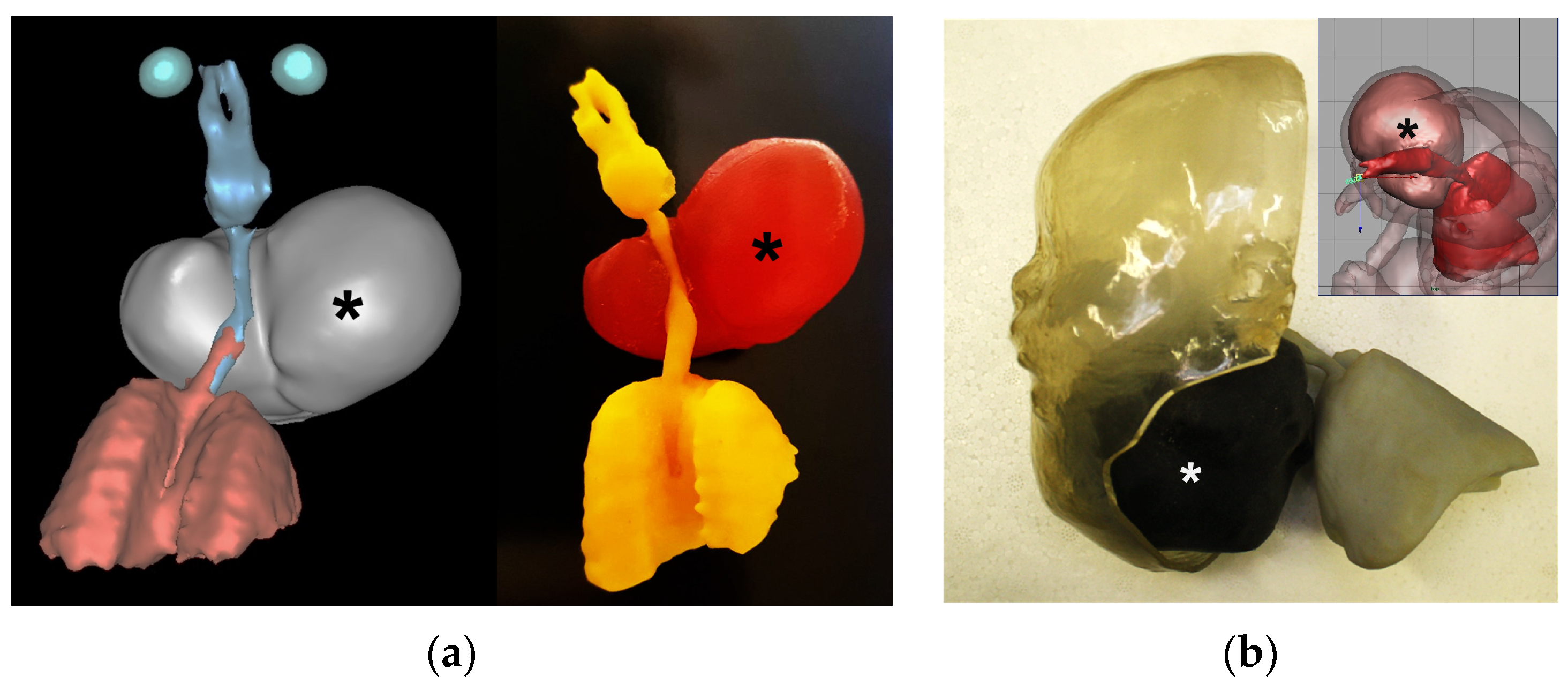 Jcm 13 04999 g003 Jcm 13 04999 g003