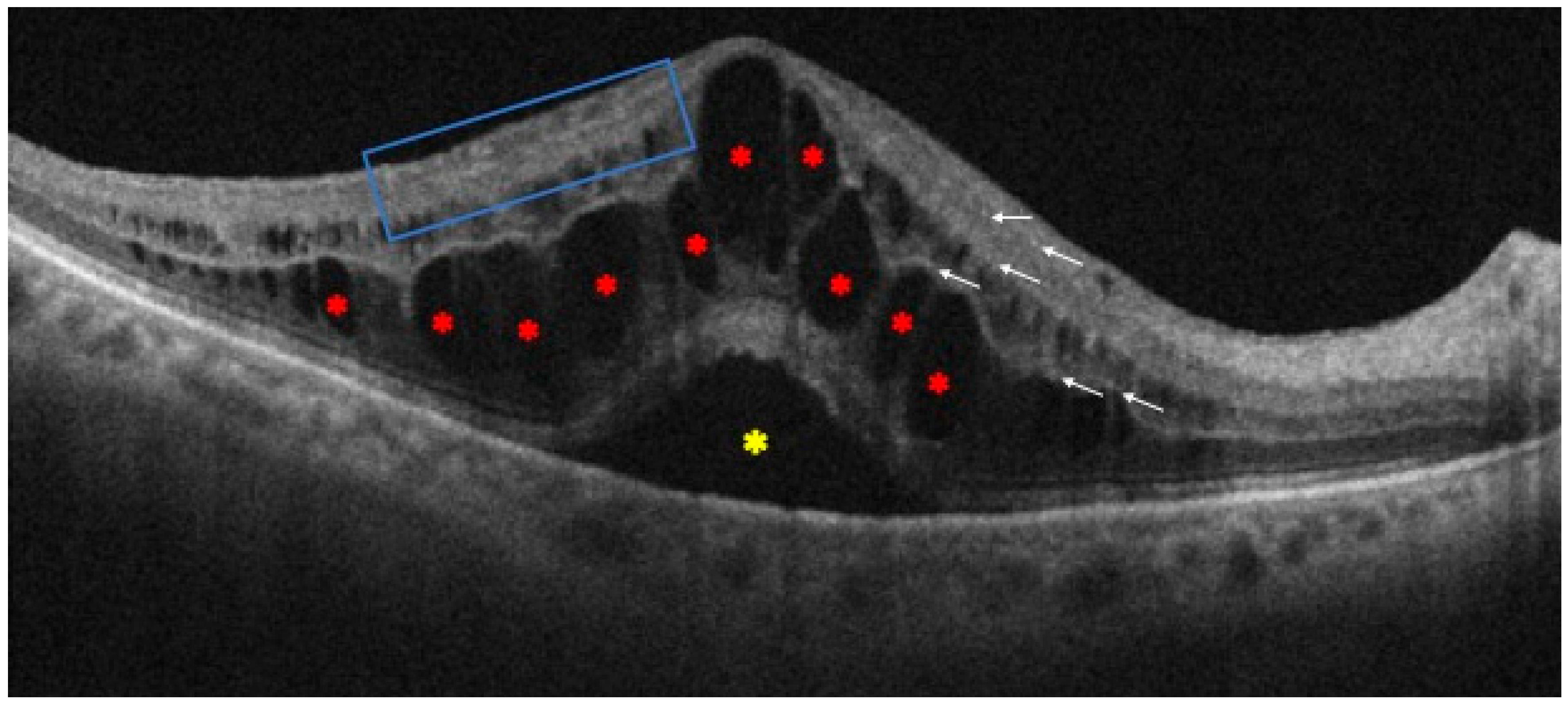 Jcm 13 05006 g004 Jcm 13 05006 g004
